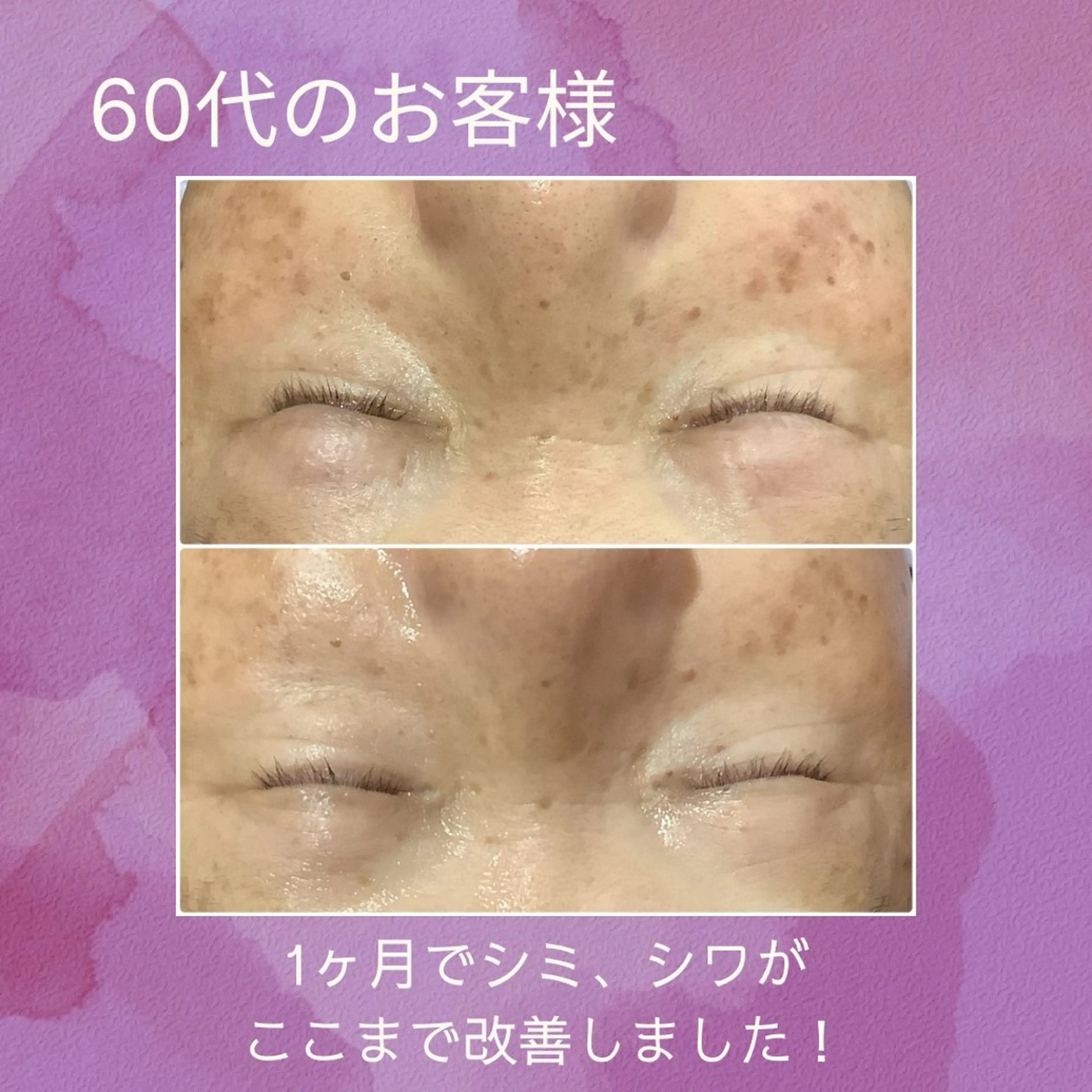 エステ エステティックジュビラン【アメジスト】所属・アメジスト 松原あんなのエステ・リラクイメージ