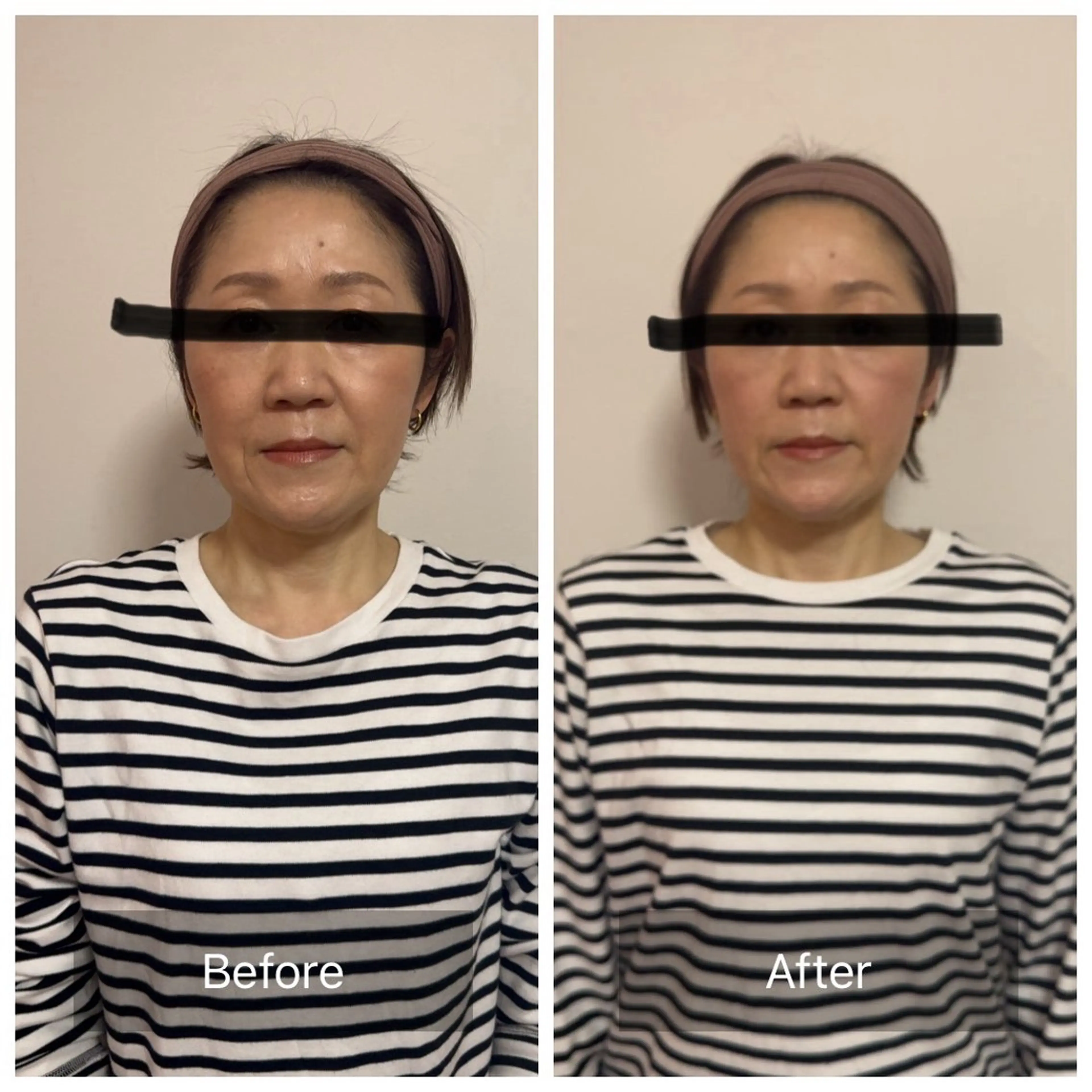 【第一印象丸ごと】リノベーションの写真