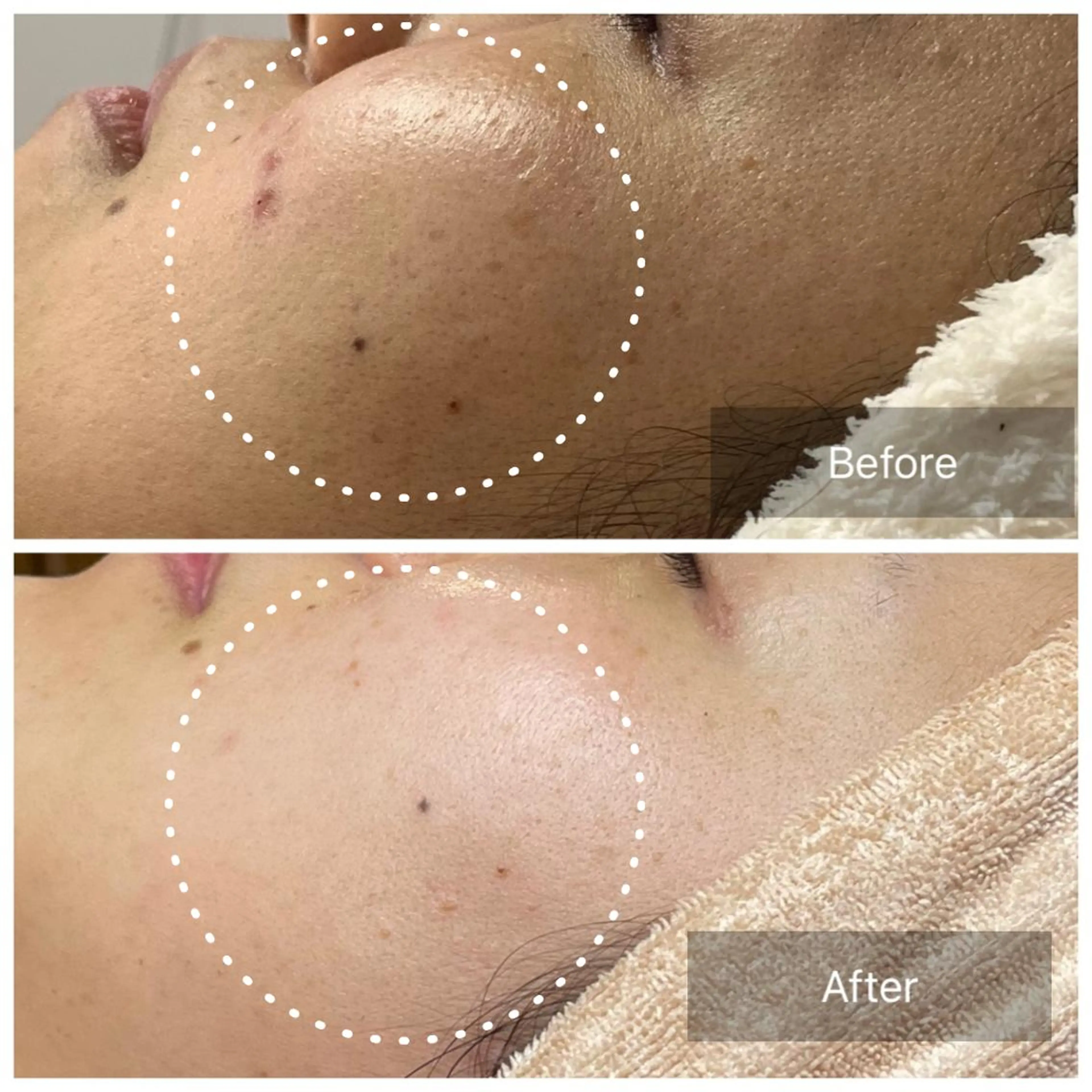 エステ 堀井 舞琳のエステ・リラクイメージ