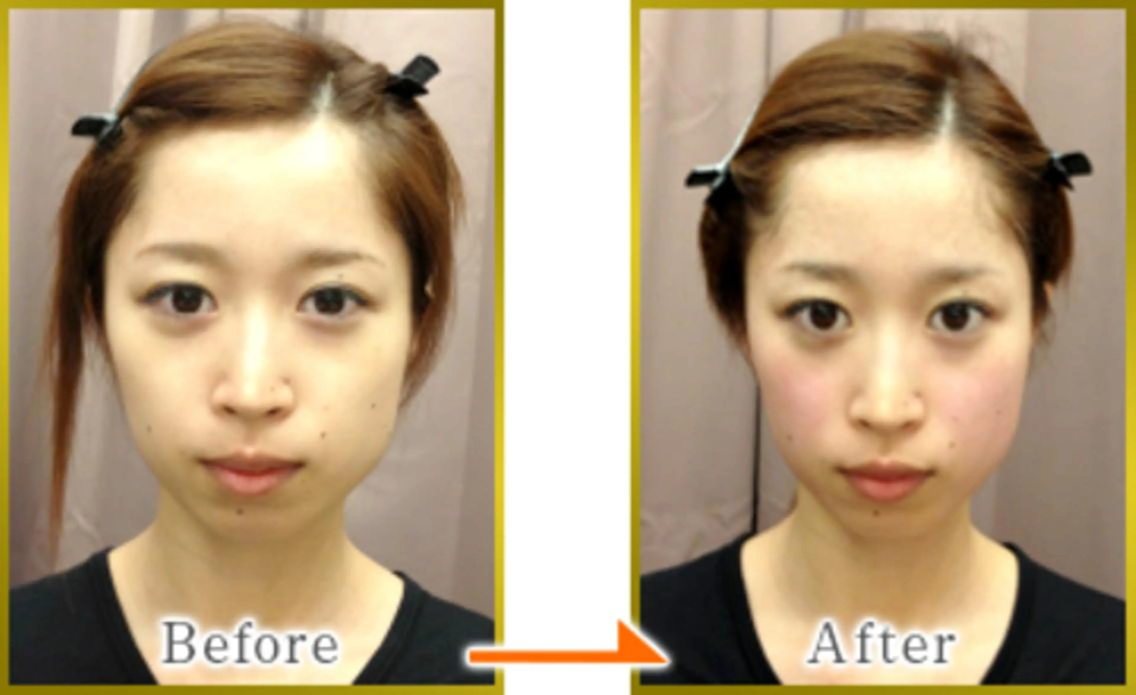 エステ 美容鍼灸サロン LOMIHARIのエステ・リラクイメージ