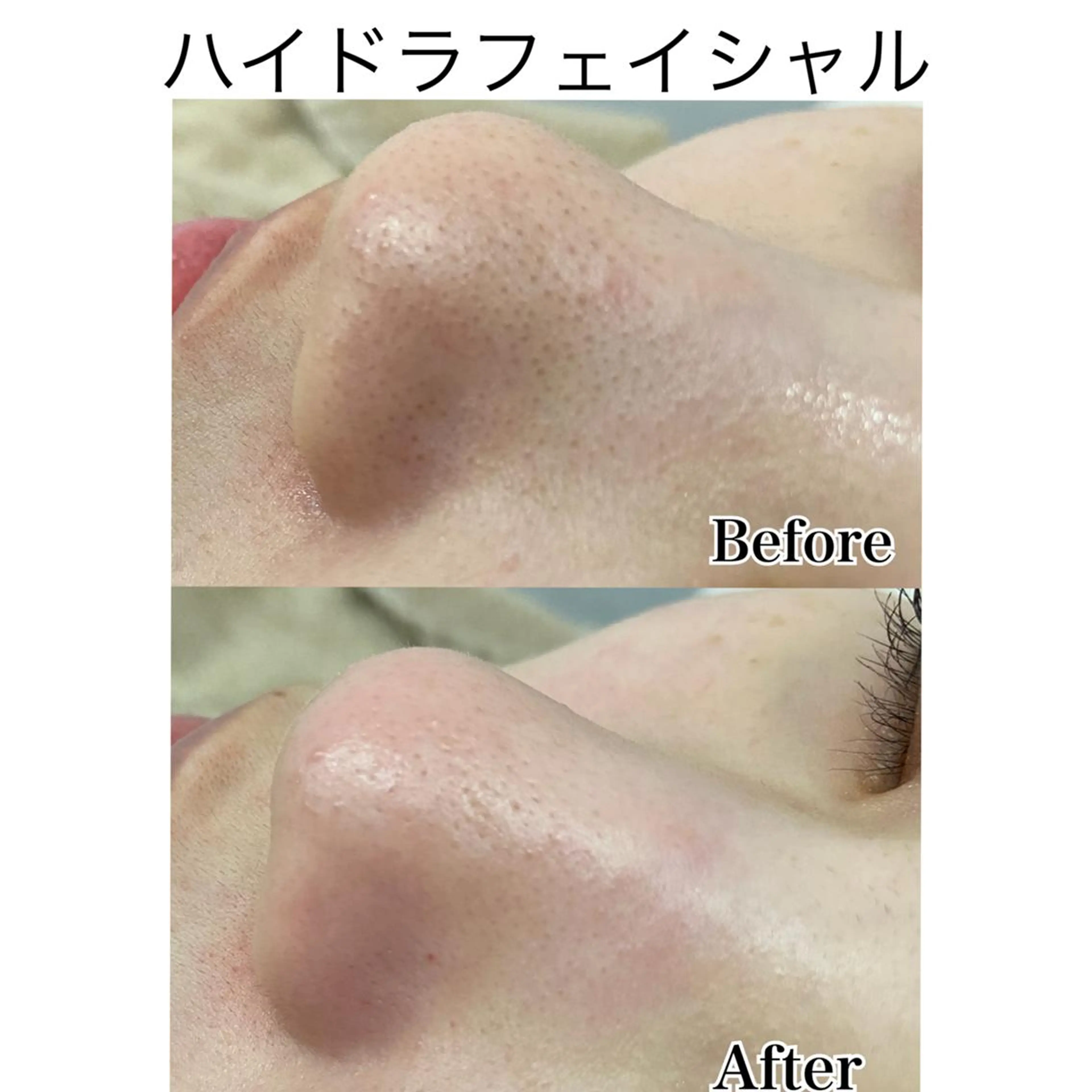 美肌サロンTIAM by tetoteのエステ・リラクイメージ