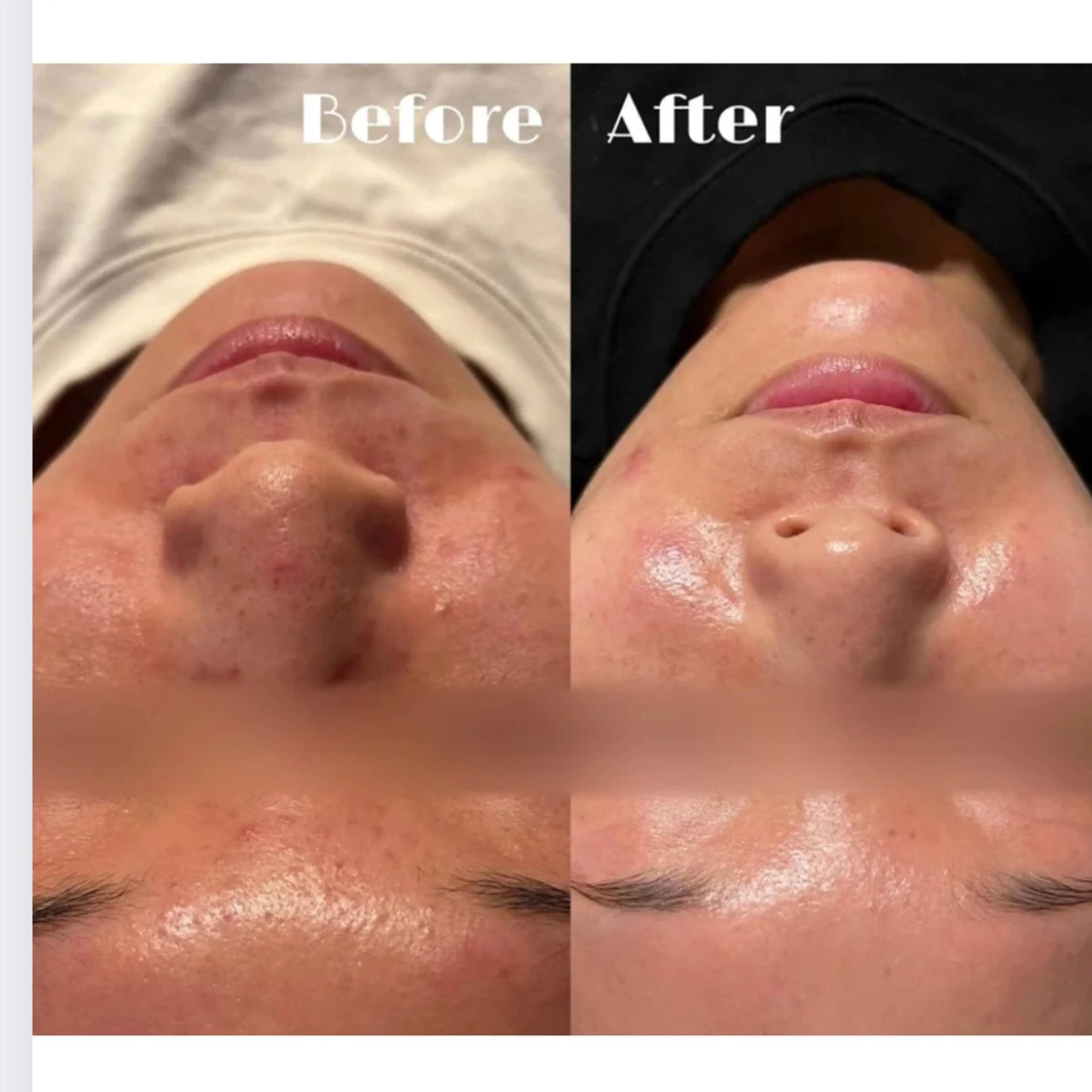 # fu♡のエステ・リラクイメージ