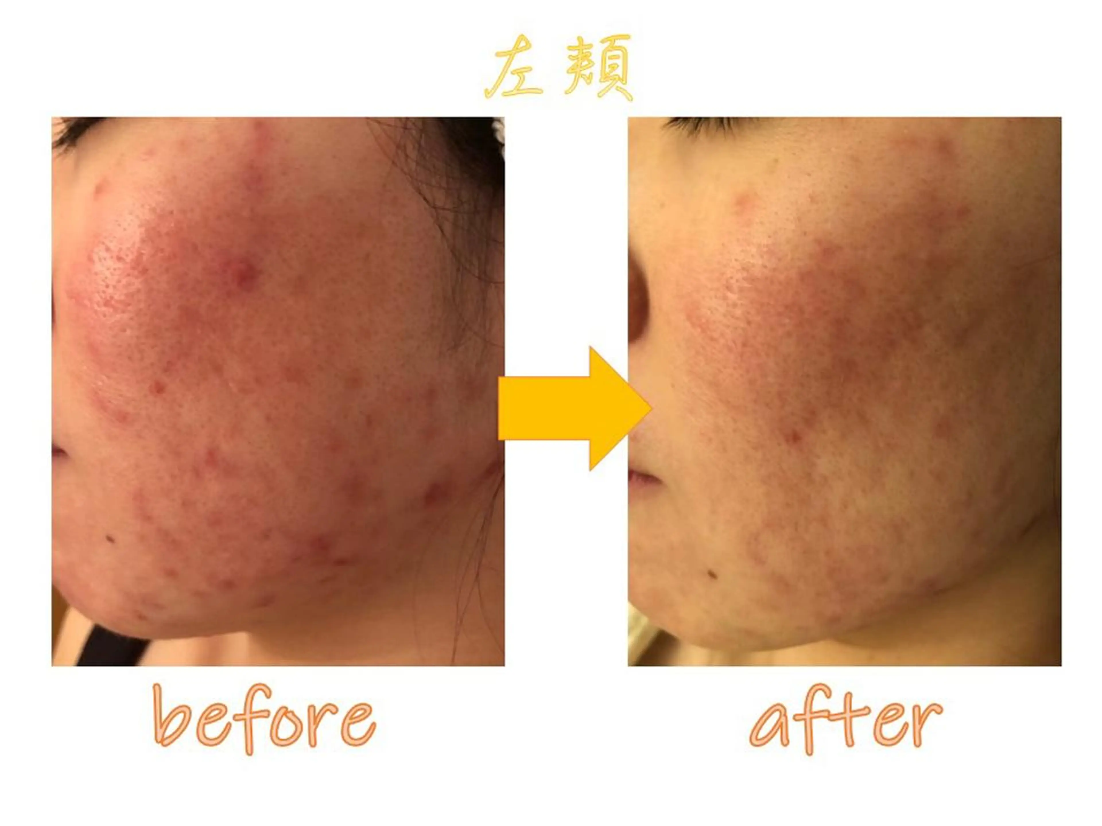 ニキビ専門サロン ド　ミモザのエステ・リラクイメージ