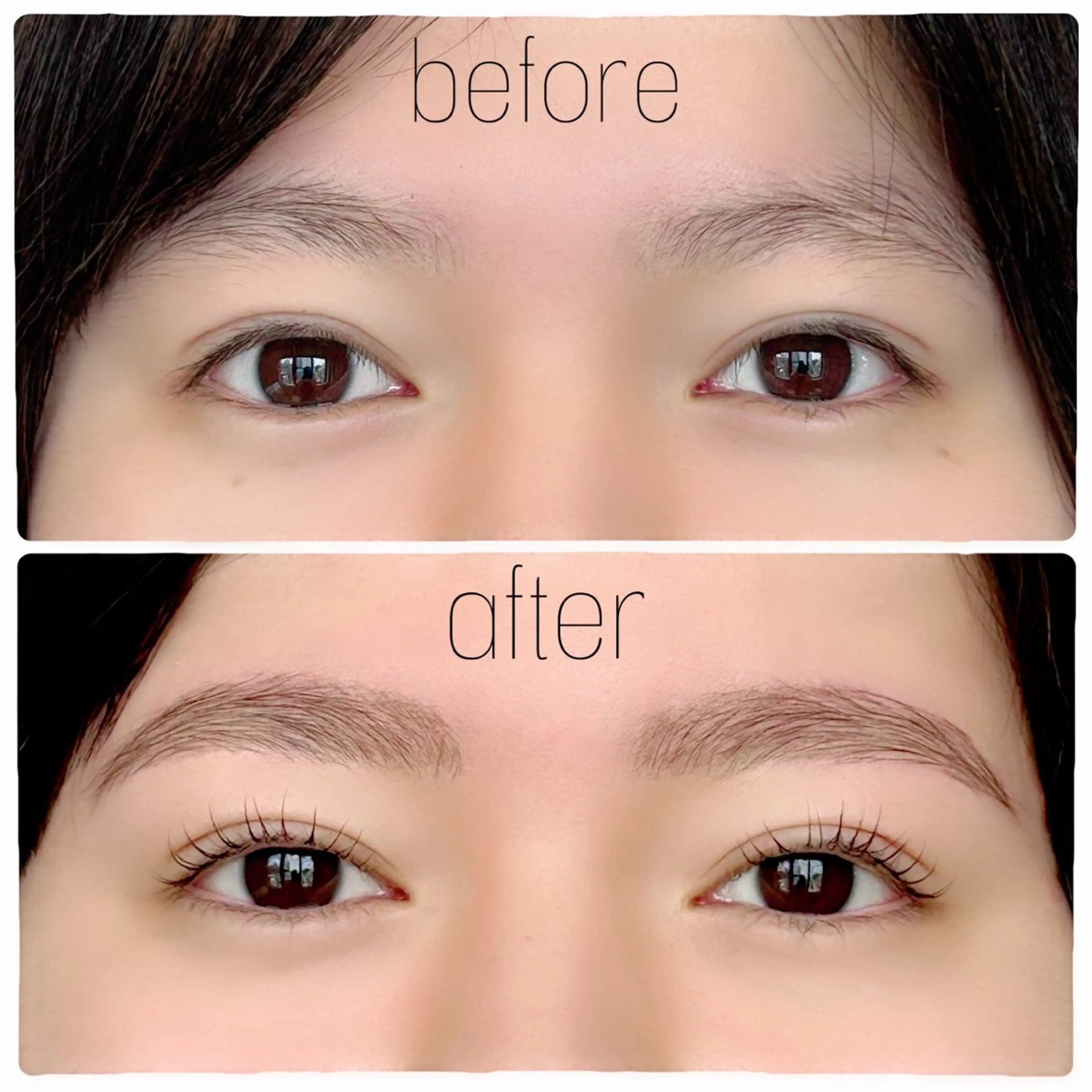 HBL(ハリウッドブロウリフト)の写真