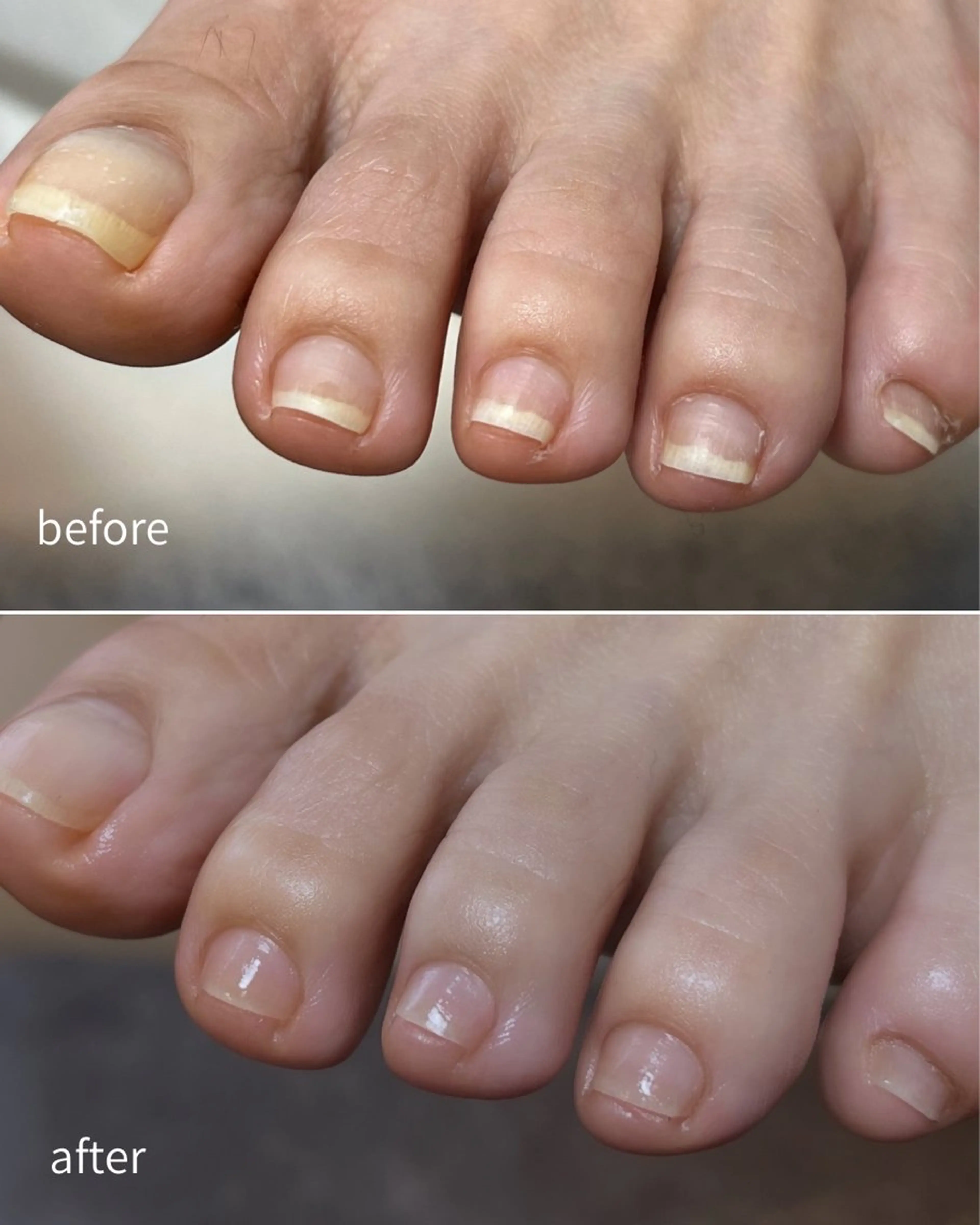 ネイル フットネイル VERMA 育爪・ケア専門のネイルデザイン