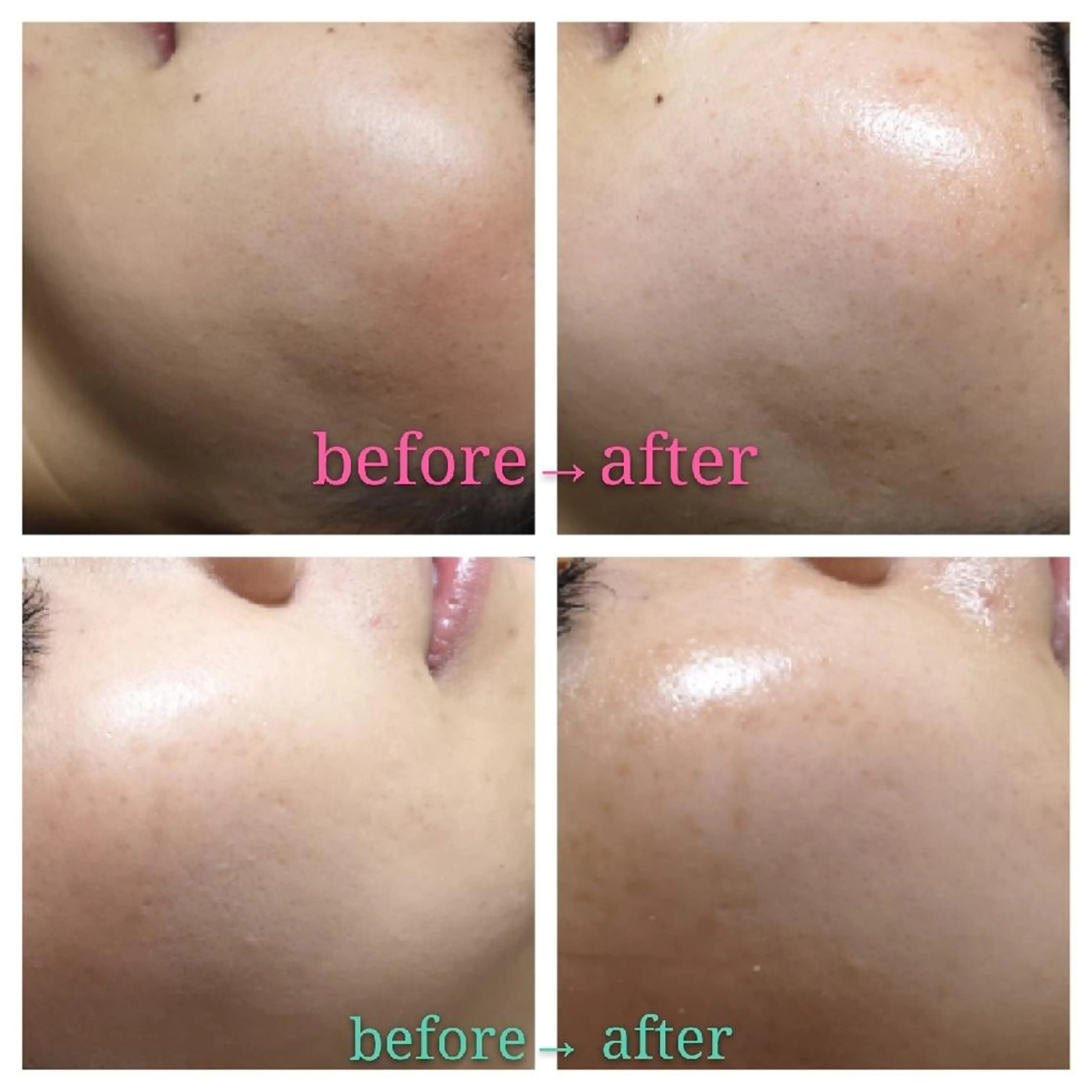 🅖🅤🅩🅔🅛 salonのエステ・リラクイメージ