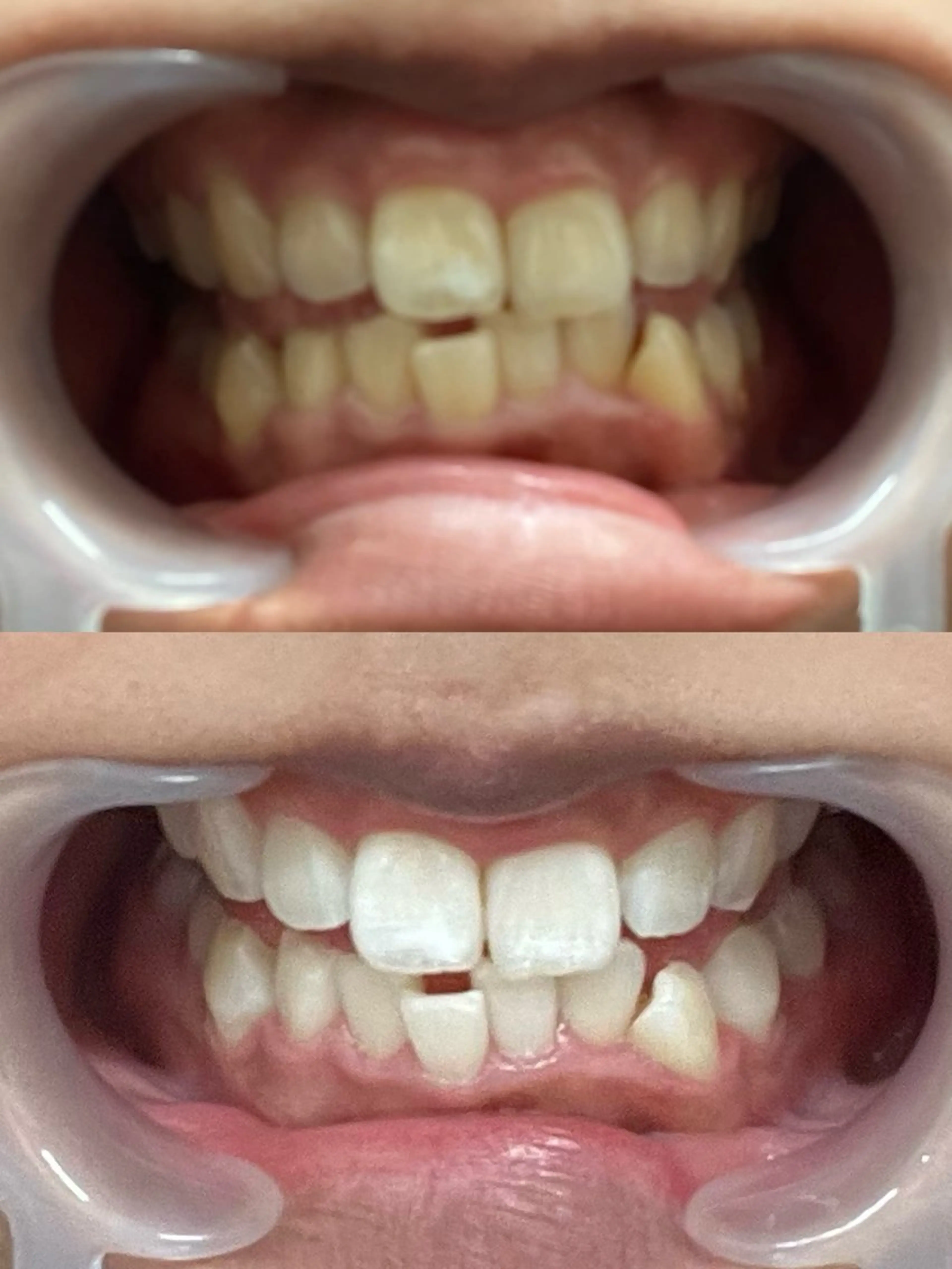 その他 セルフホワイトニング 池袋　プラネットのその他イメージ