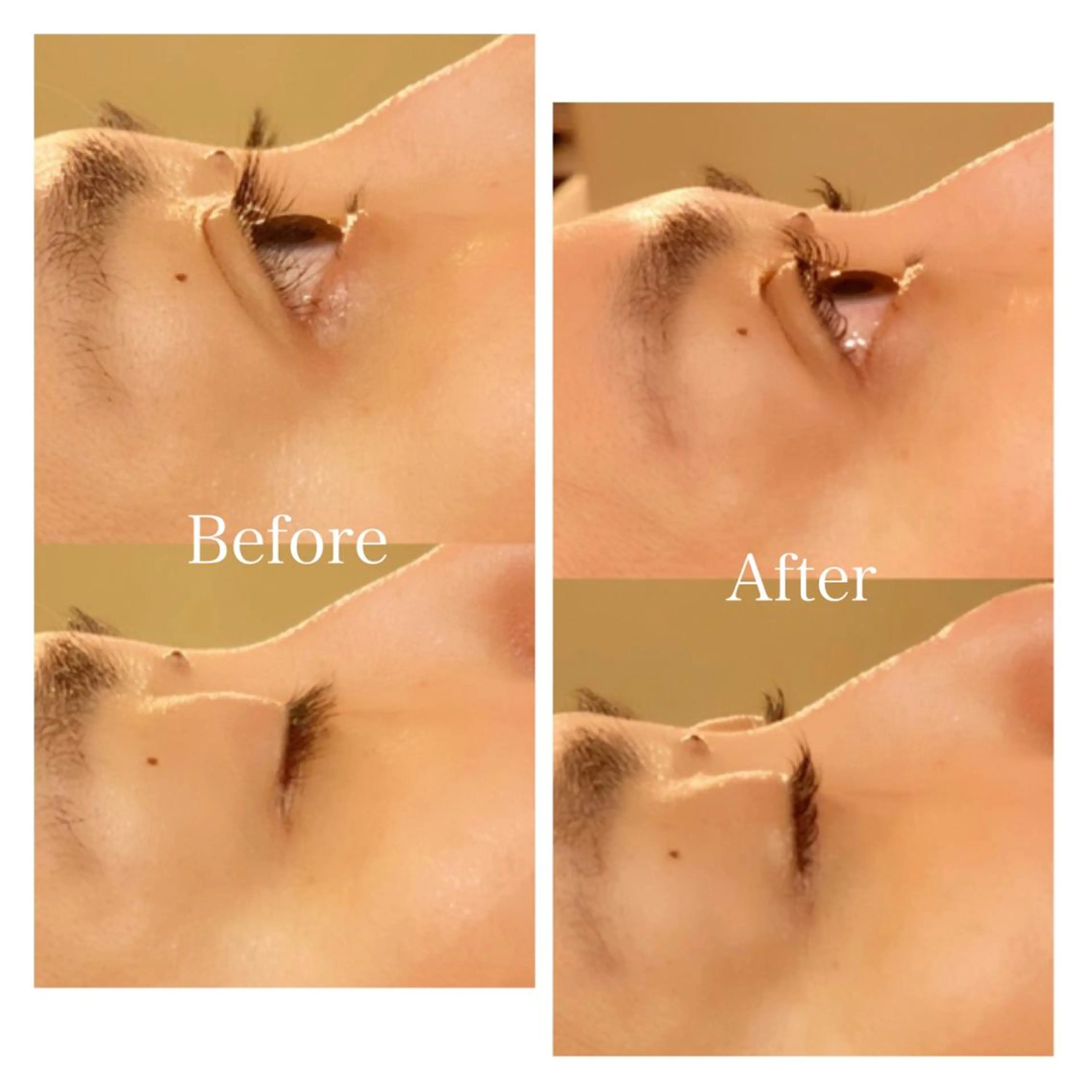 マツエク・マツパ 西岡 美香子のネイルデザイン