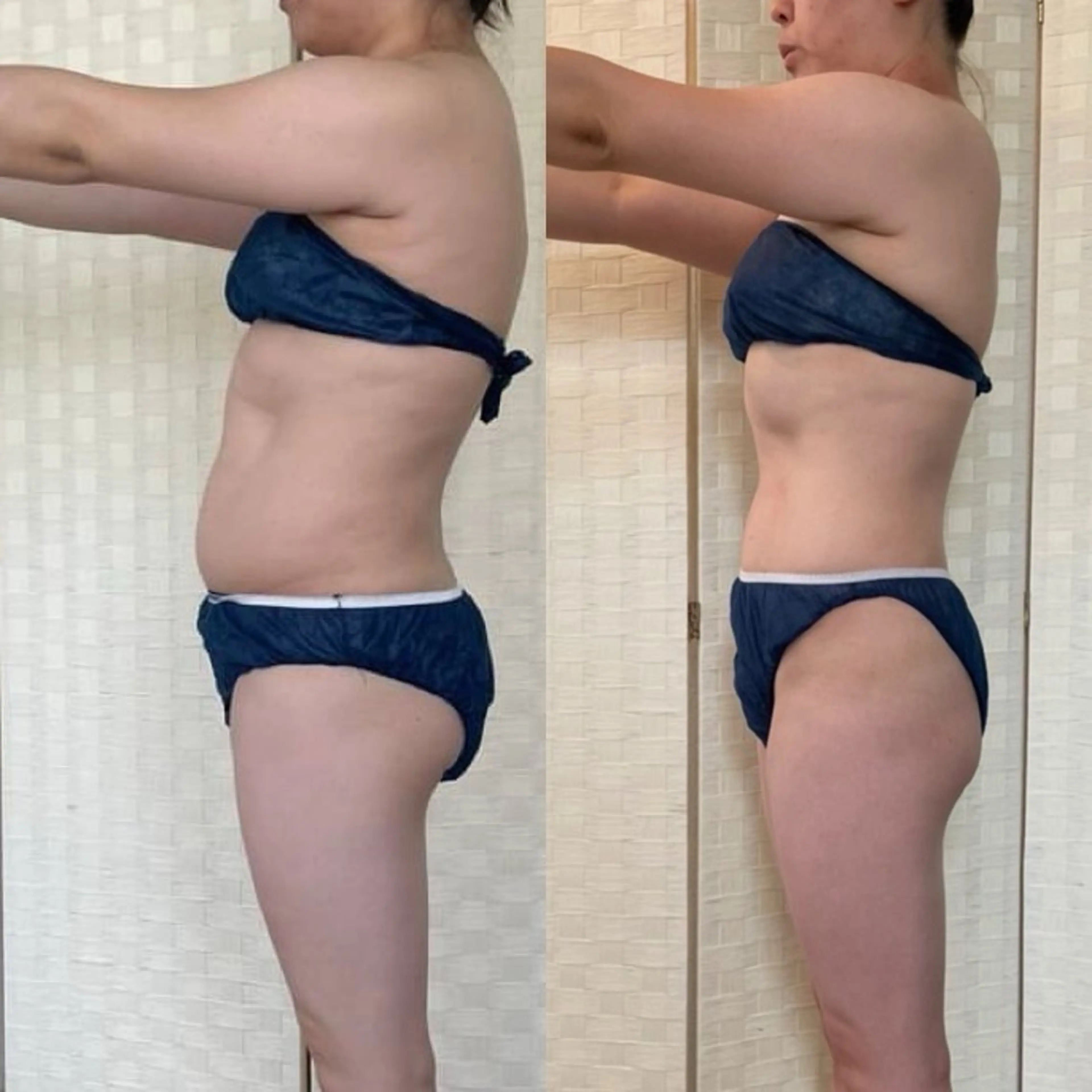 全身痩身リンパダイエット150分の写真