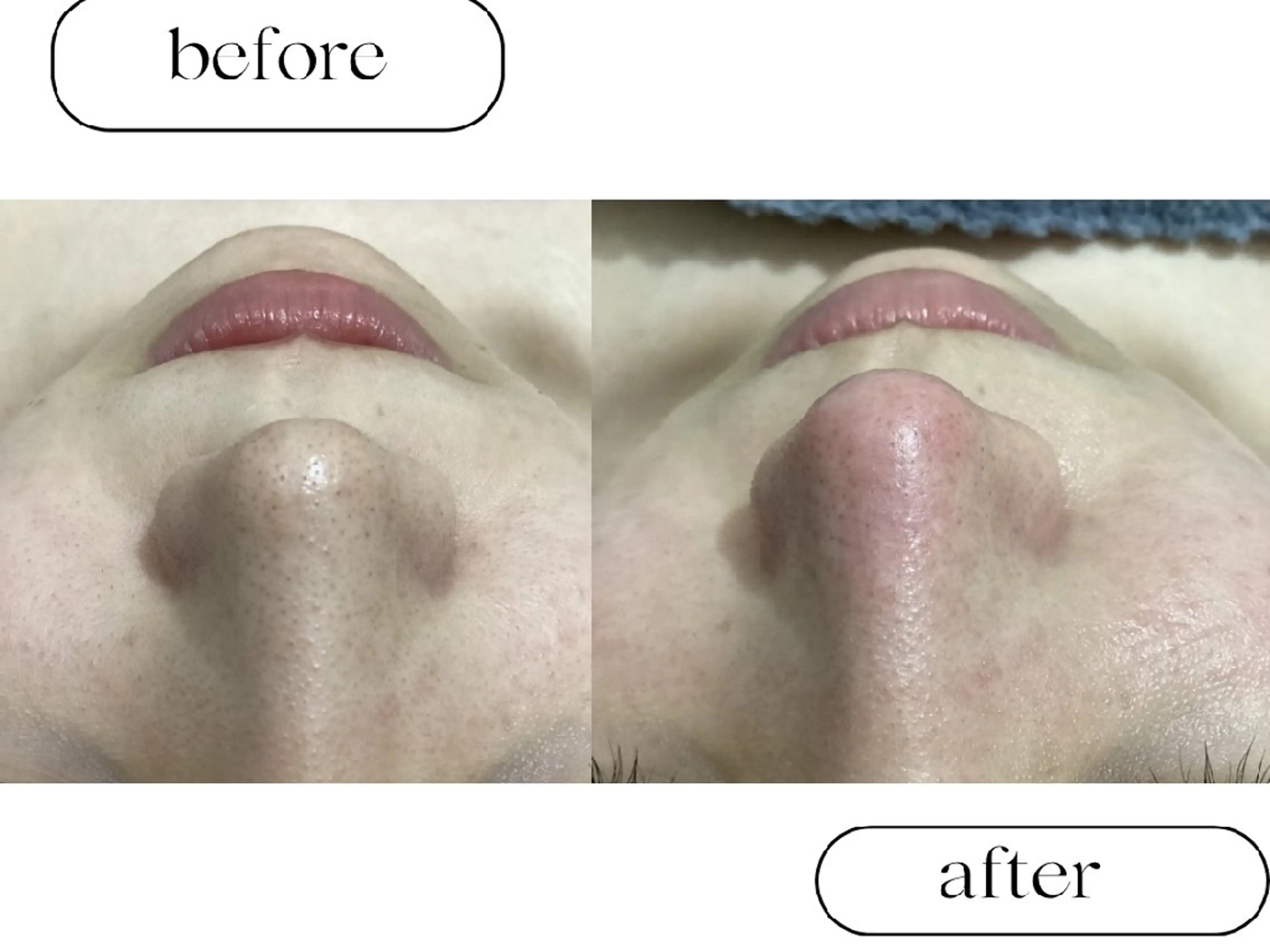 美肌専門サロン RUBONのエステ・リラクイメージ