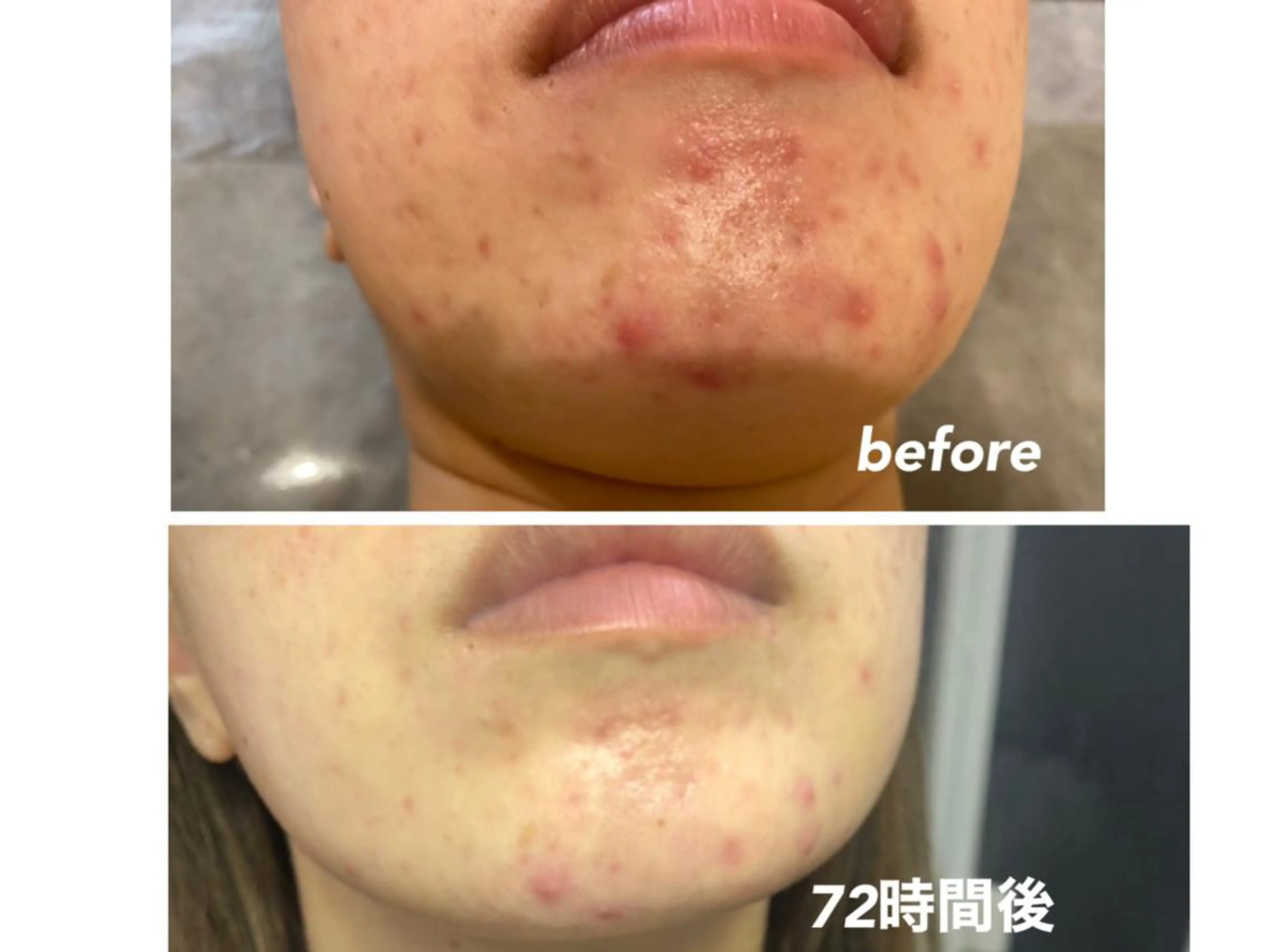 エステ ビューティサロン aiwaのエステ・リラクイメージ