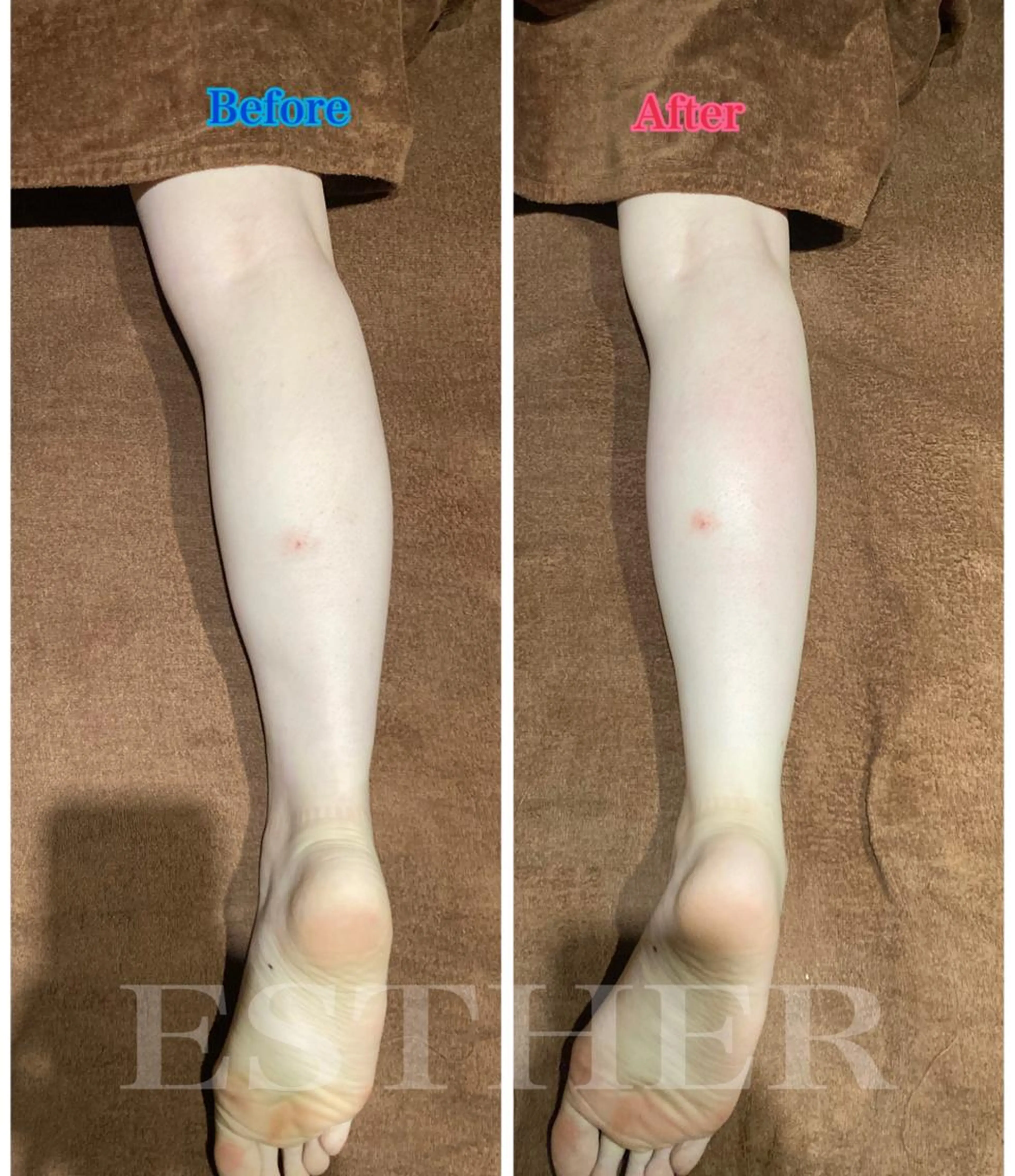 ✴️【フットマッサージ】浮腫みやすいふくらはぎに休息を‼️ 単品・組み合わせ🆗の写真