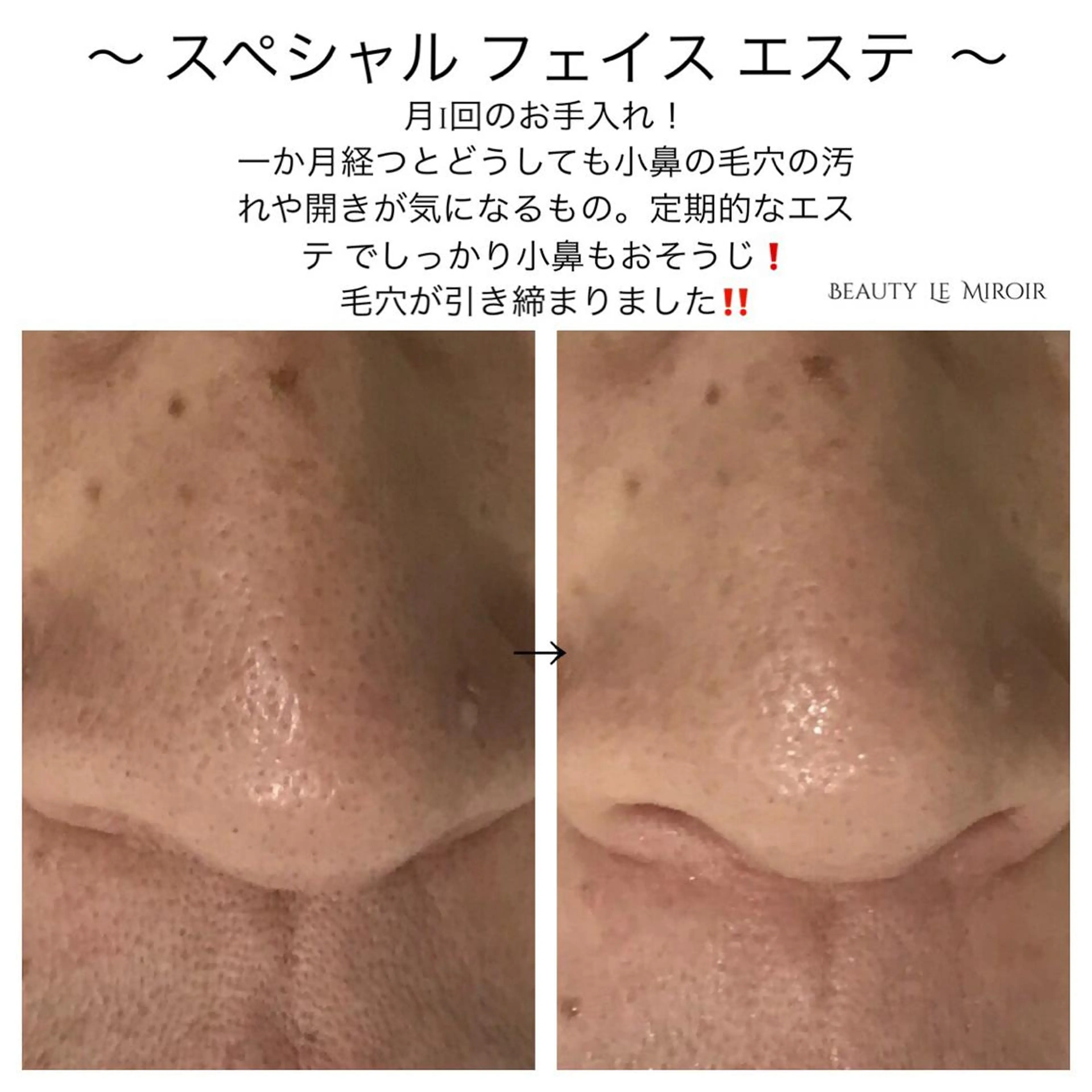 マツエク・マツパ ビューティー ミロワールのエステ・リラクイメージ