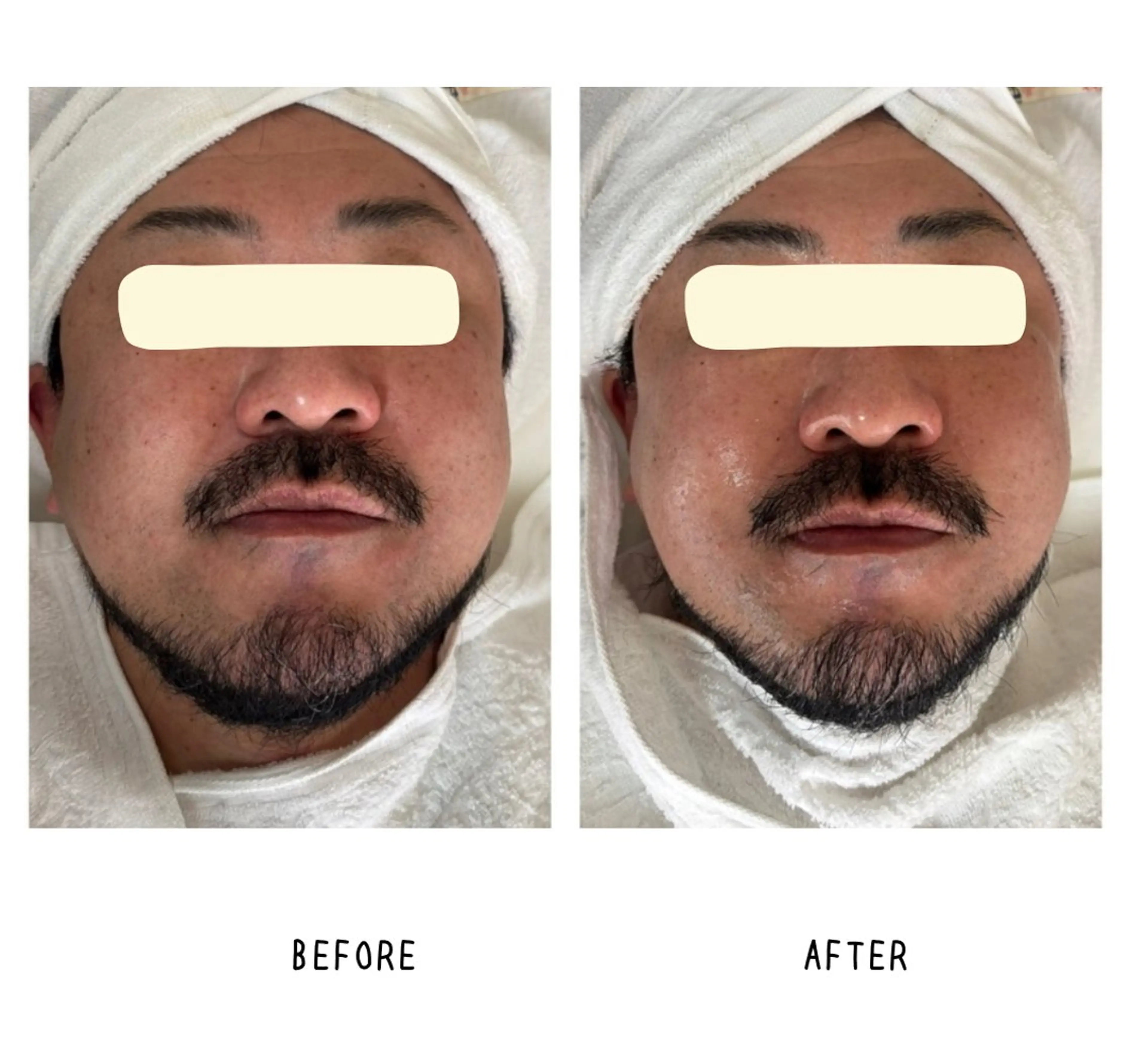 grow所属・Yoshino Erinaのエステ・リラクイメージ