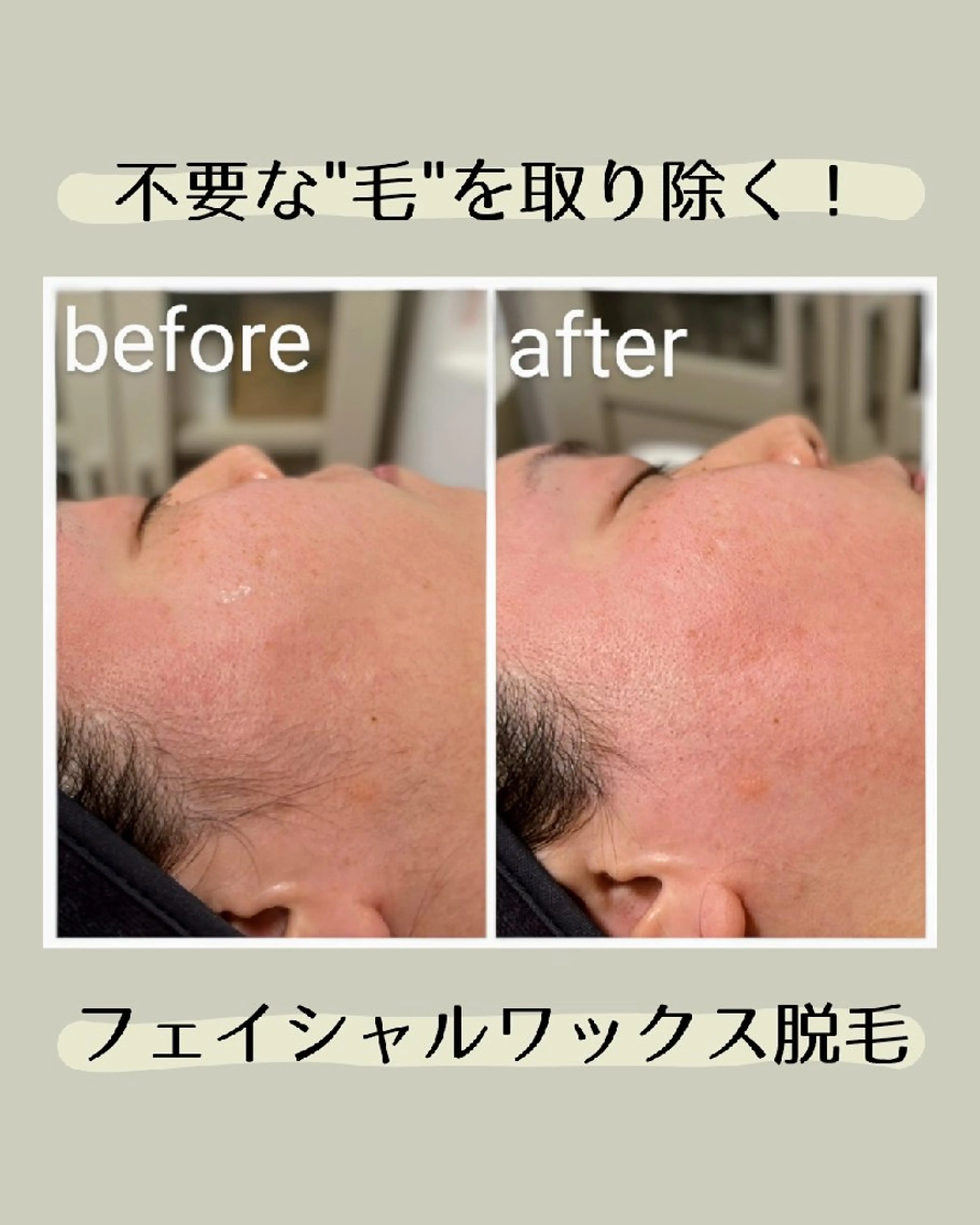 脱毛 濱田 優子のエステ・リラクイメージ