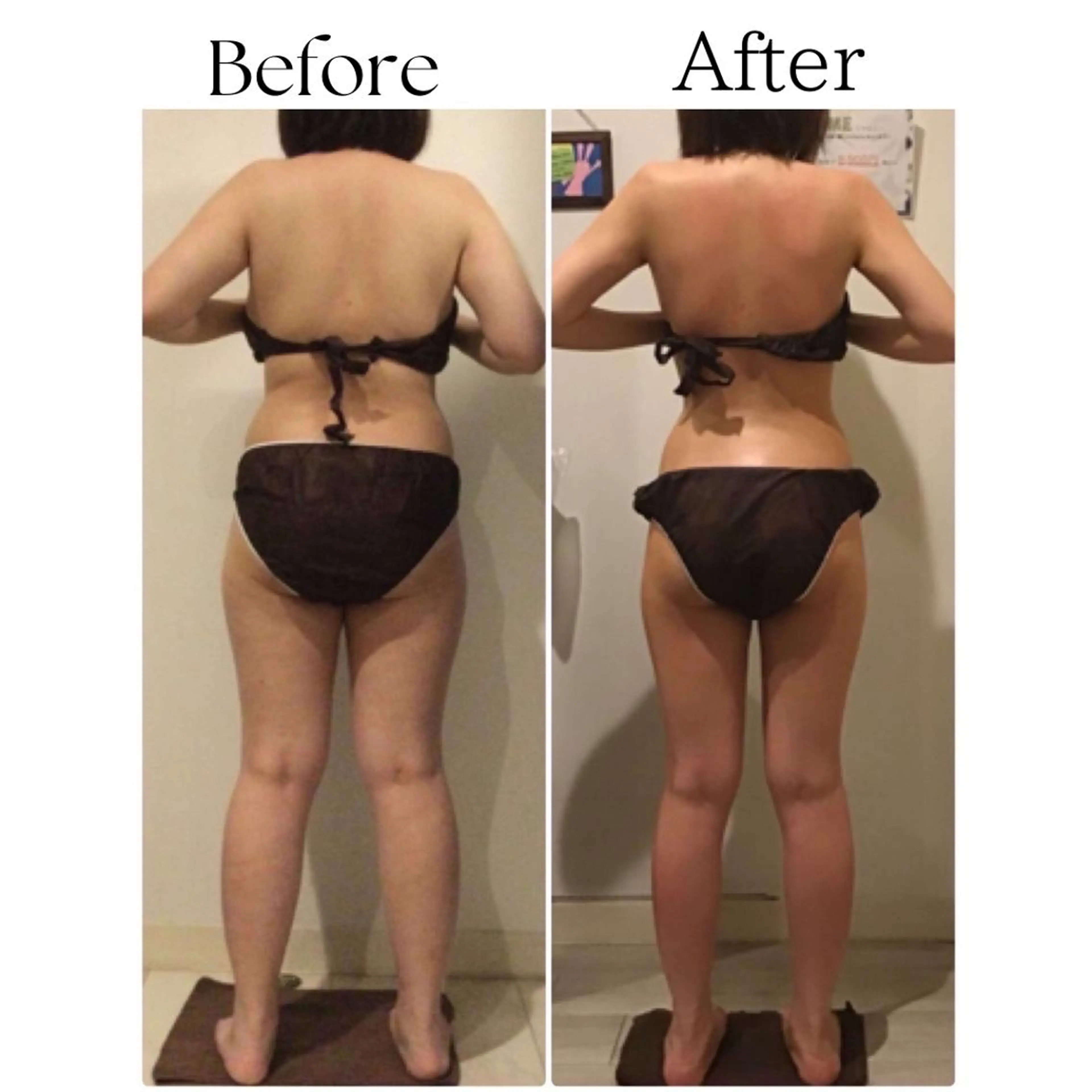 ★すぐ予約・時間指定あり★通い放題3工程╋セルライトケア研修モデル下半身or上半身予定【標準体重以上の方】の写真