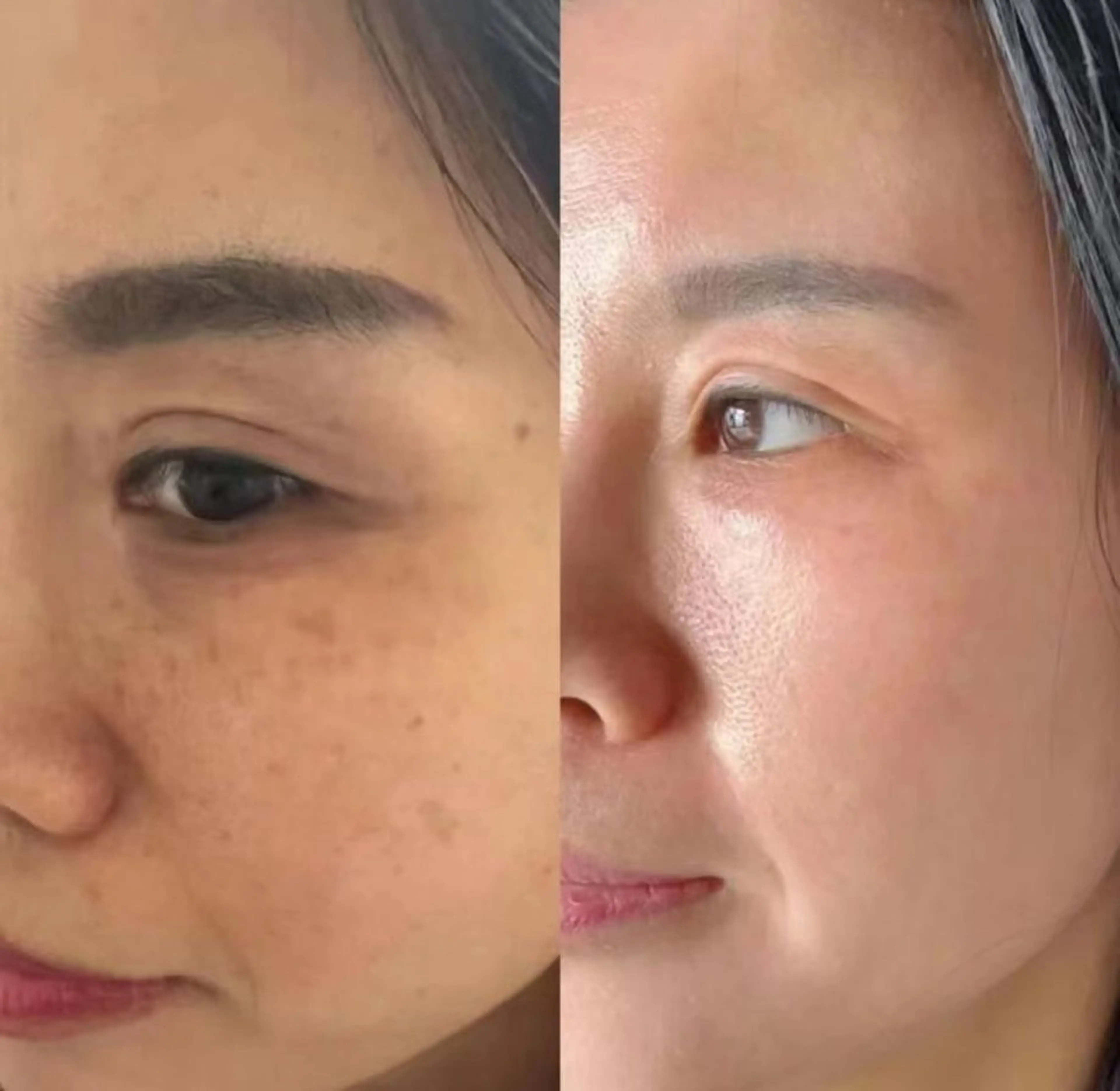 ヘアアレンジ エステ aliaハイフ&水光ジェットサロン所属・aliaハーブ水光店 エステティシャン募集のエステ・リラクイメージ