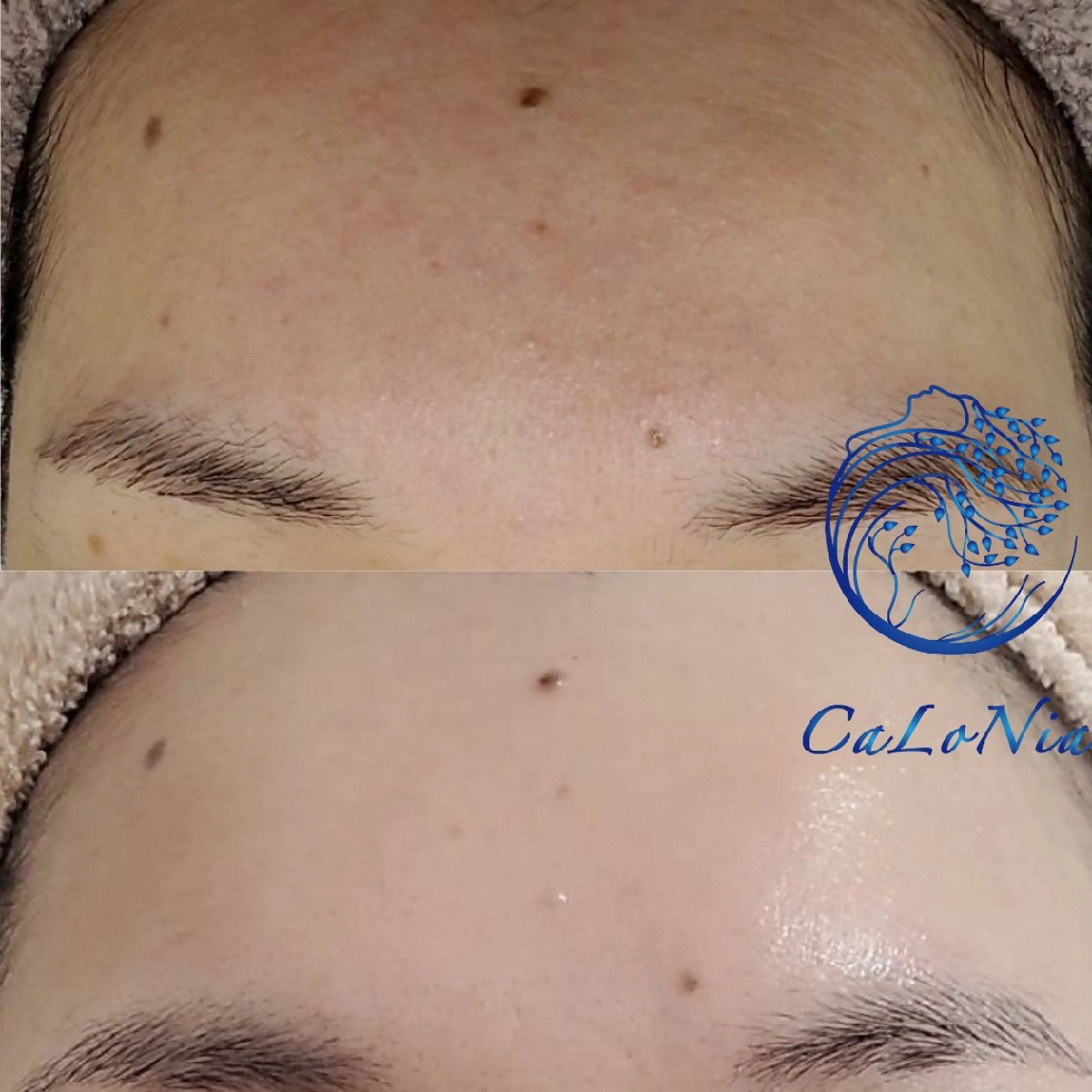 肌質改善・艶髪サロン CaLoNiaのエステ・リラクイメージ