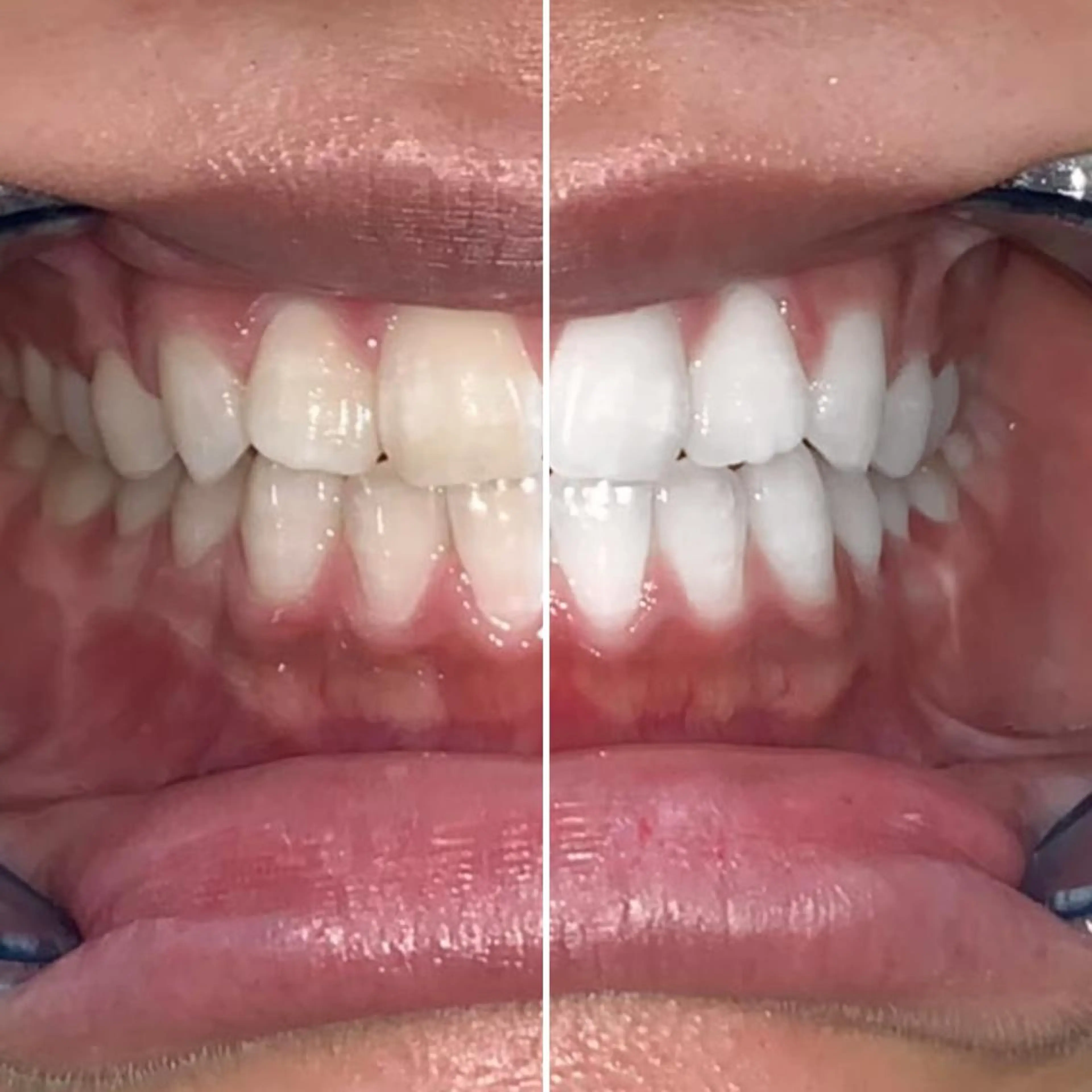 ライトビューティー 錦糸町店のエステ・リラクイメージ