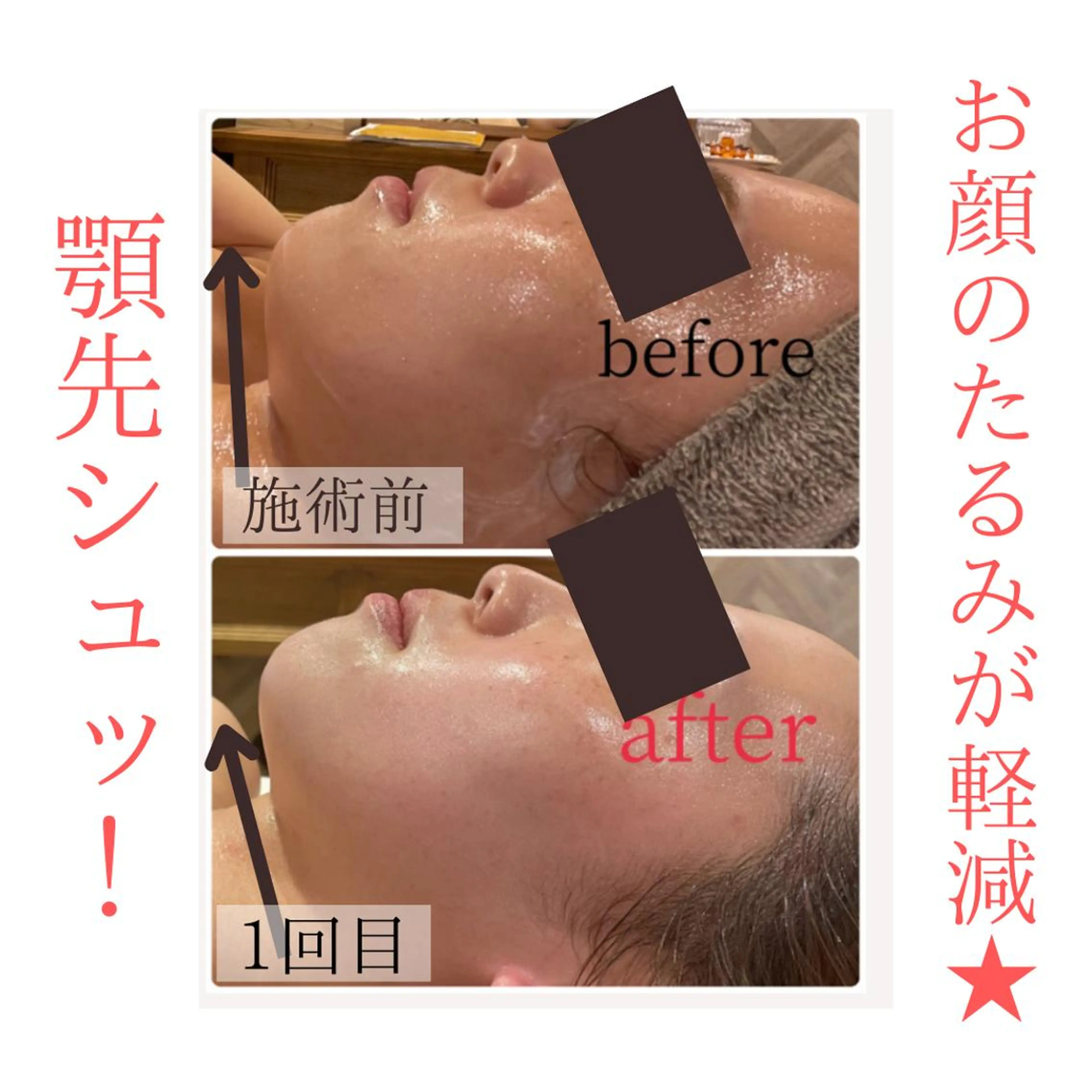 アンジュ所属・アンジュ 園田のその他イメージ