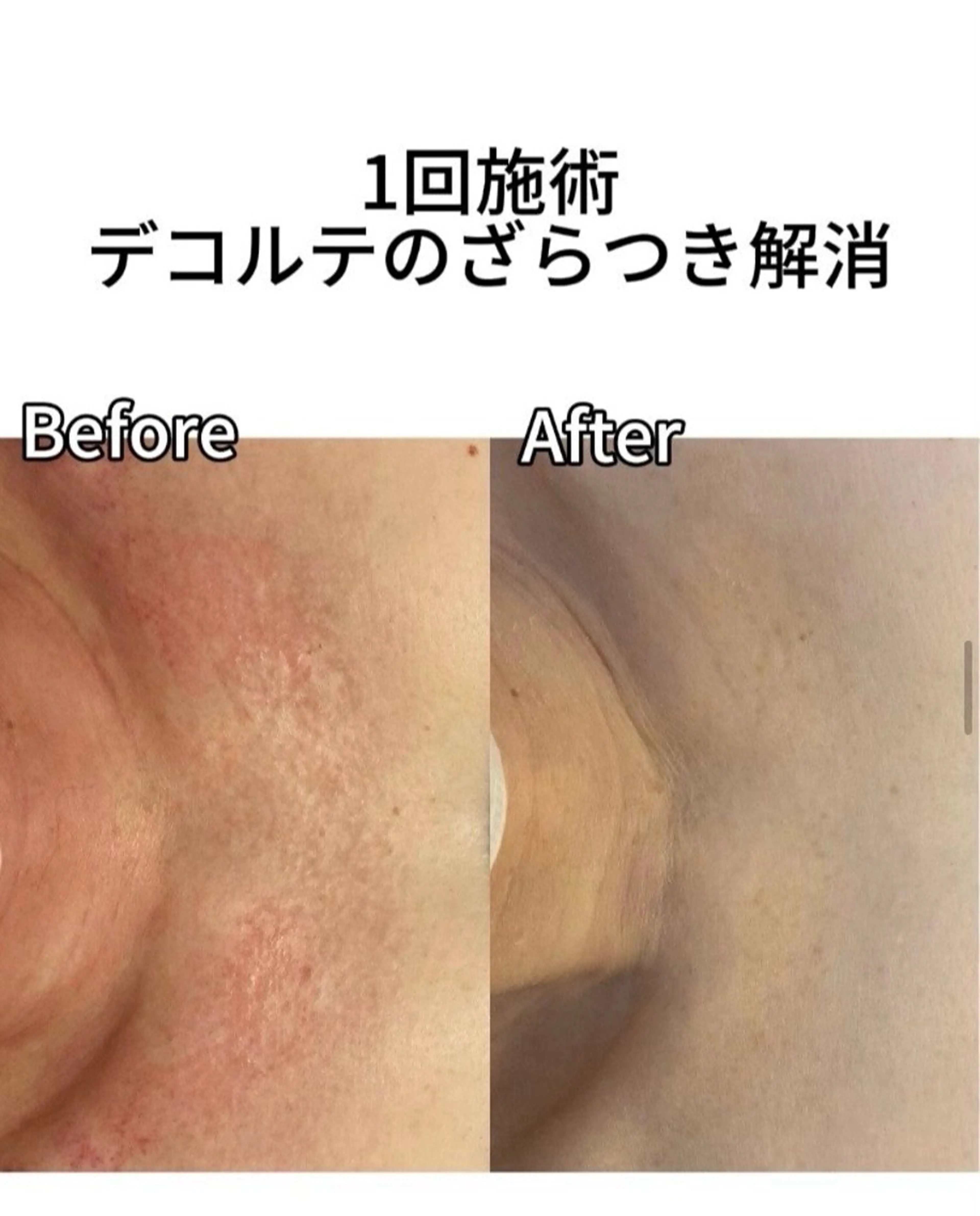 その他 30min ノジマのエステ・リラクイメージ