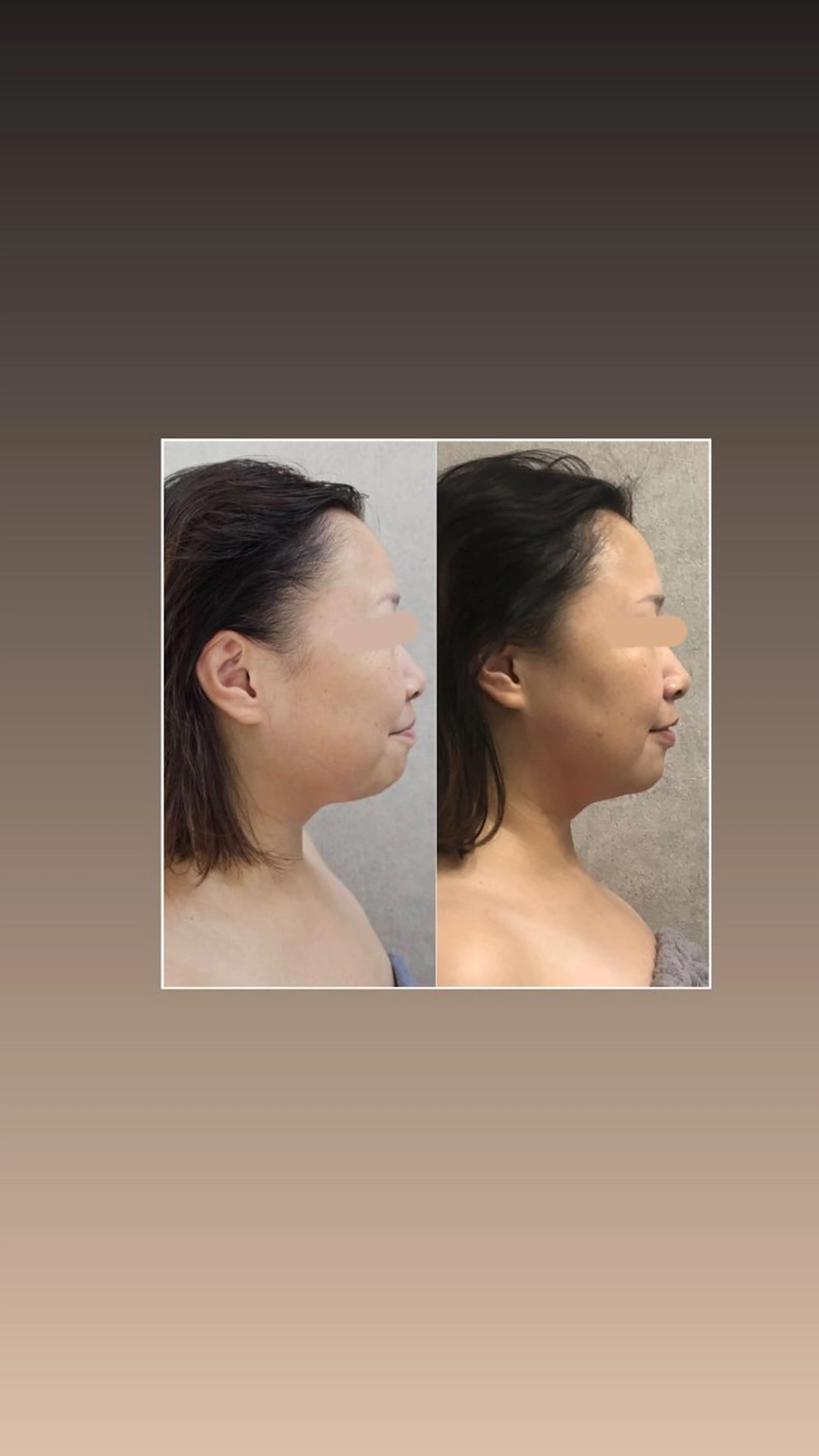 Chio-RE所属・Wax/絹肌艶肌🌼 坂結加のエステ・リラクイメージ