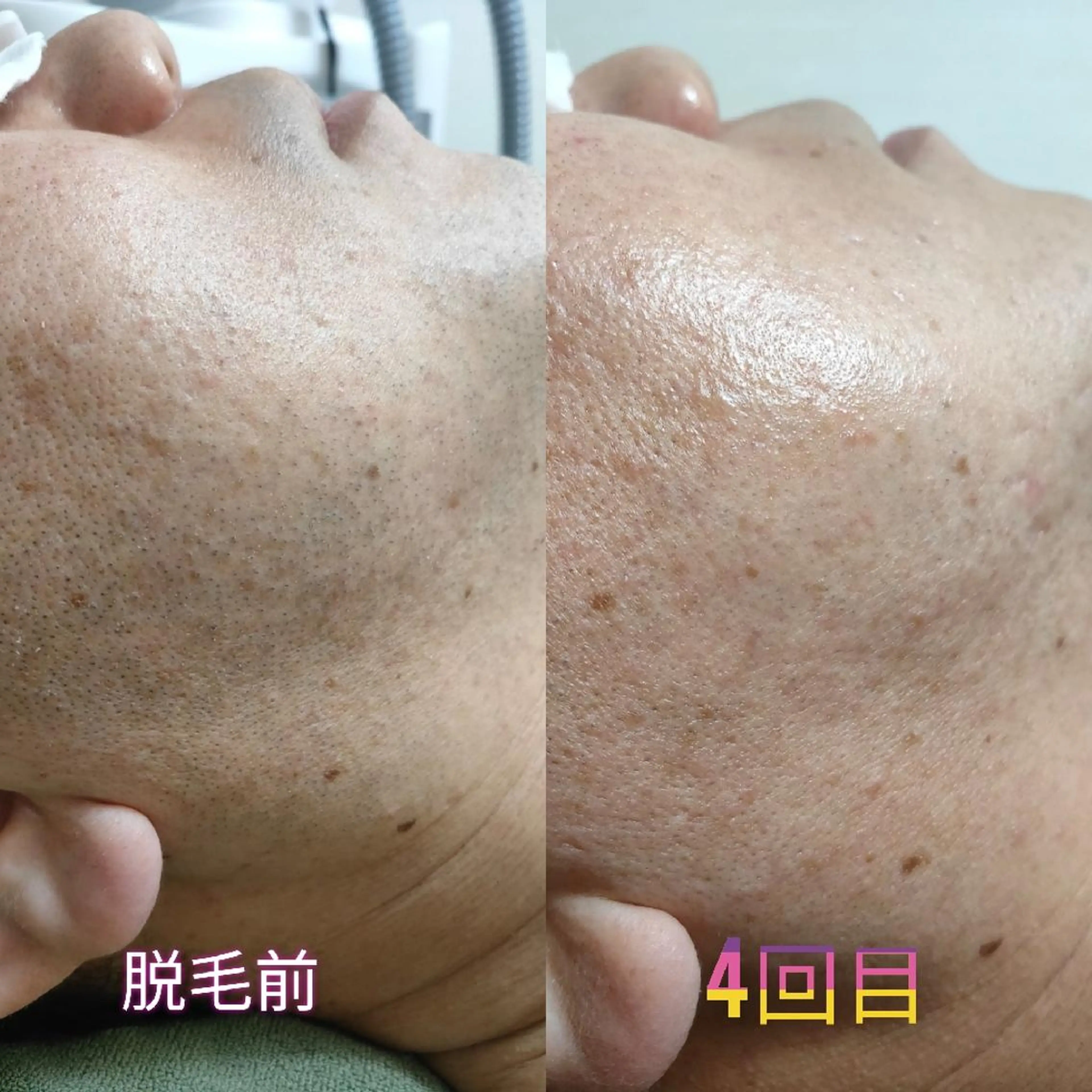 メンズ 武 藤のエステ・リラクイメージ