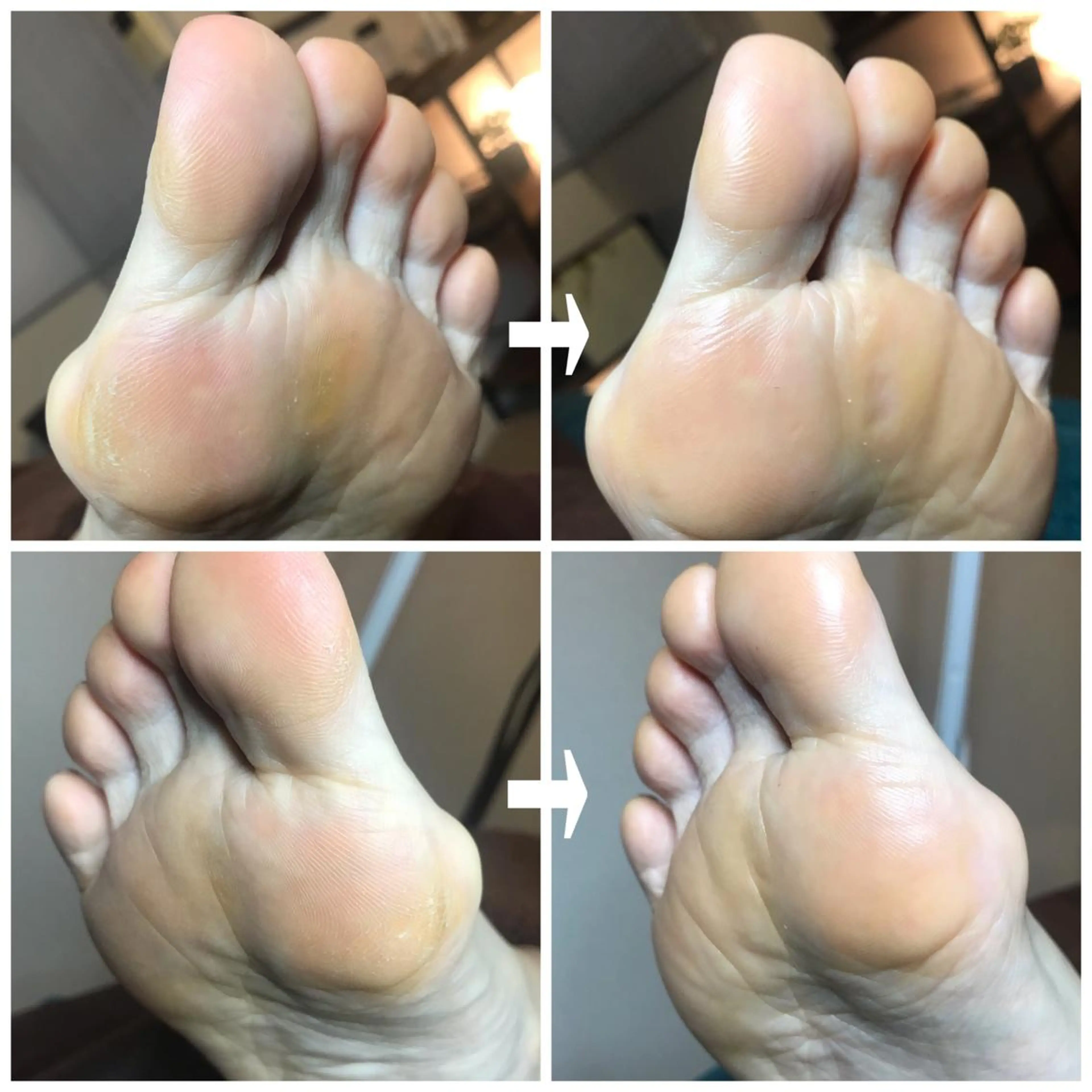 『角質ケア60分コース』の写真