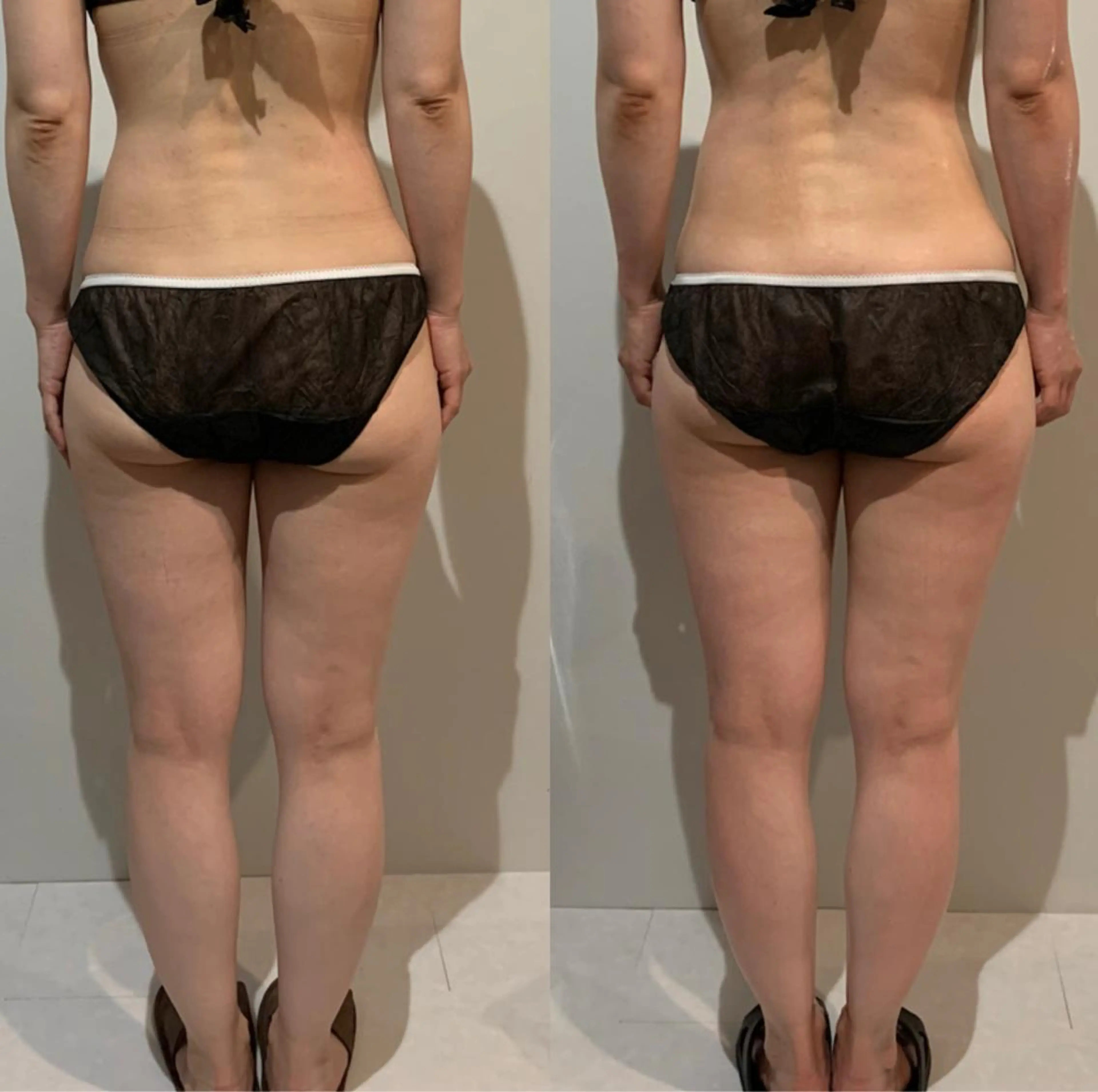 maintenance salon shinoma所属・ボディメンテナンス shinomaのエステ・リラクイメージ