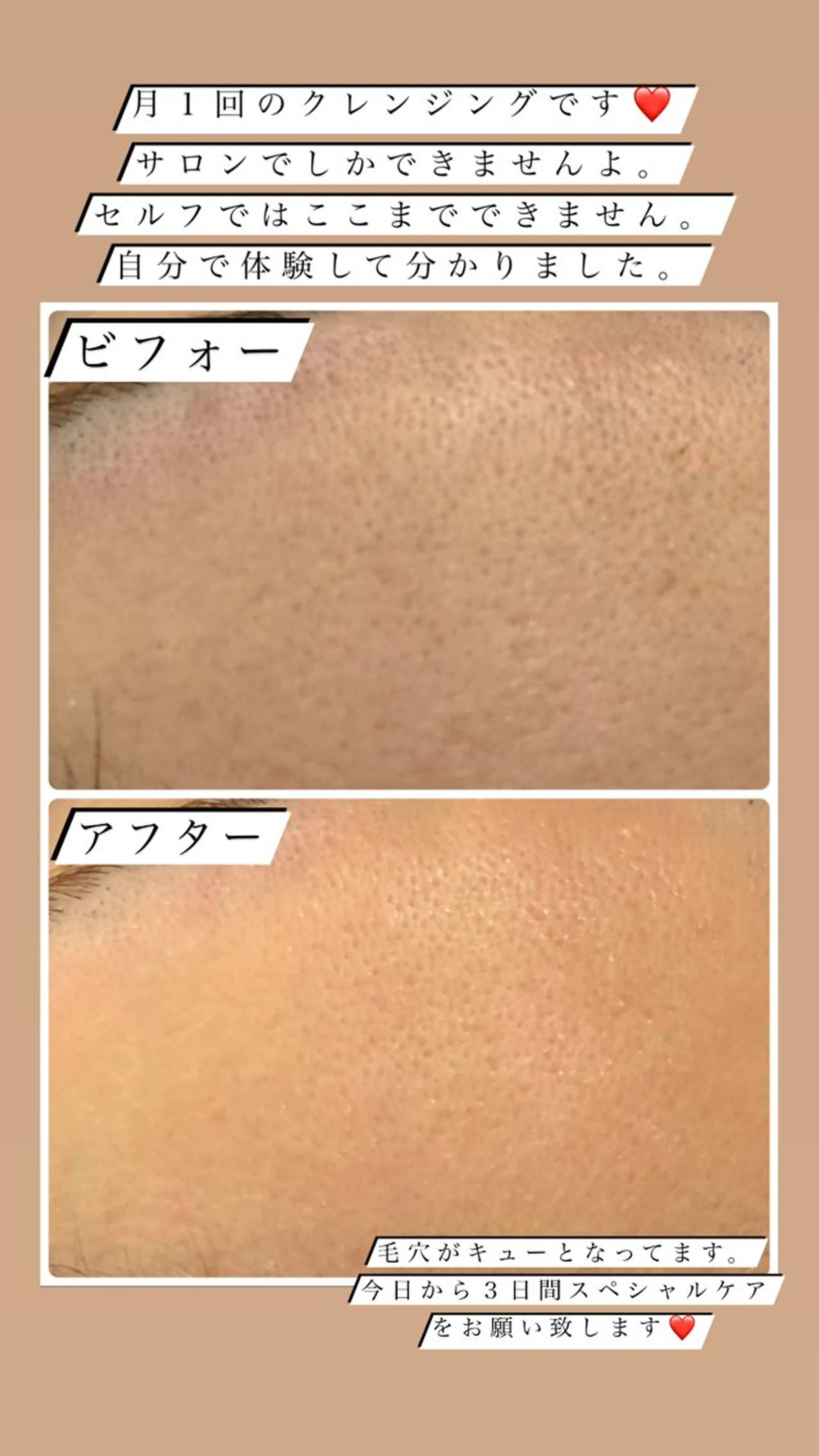 美肌脱毛fuu okinawa所属・宜野湾美肌脱毛fuu okinawaタイラのエステ・リラクイメージ