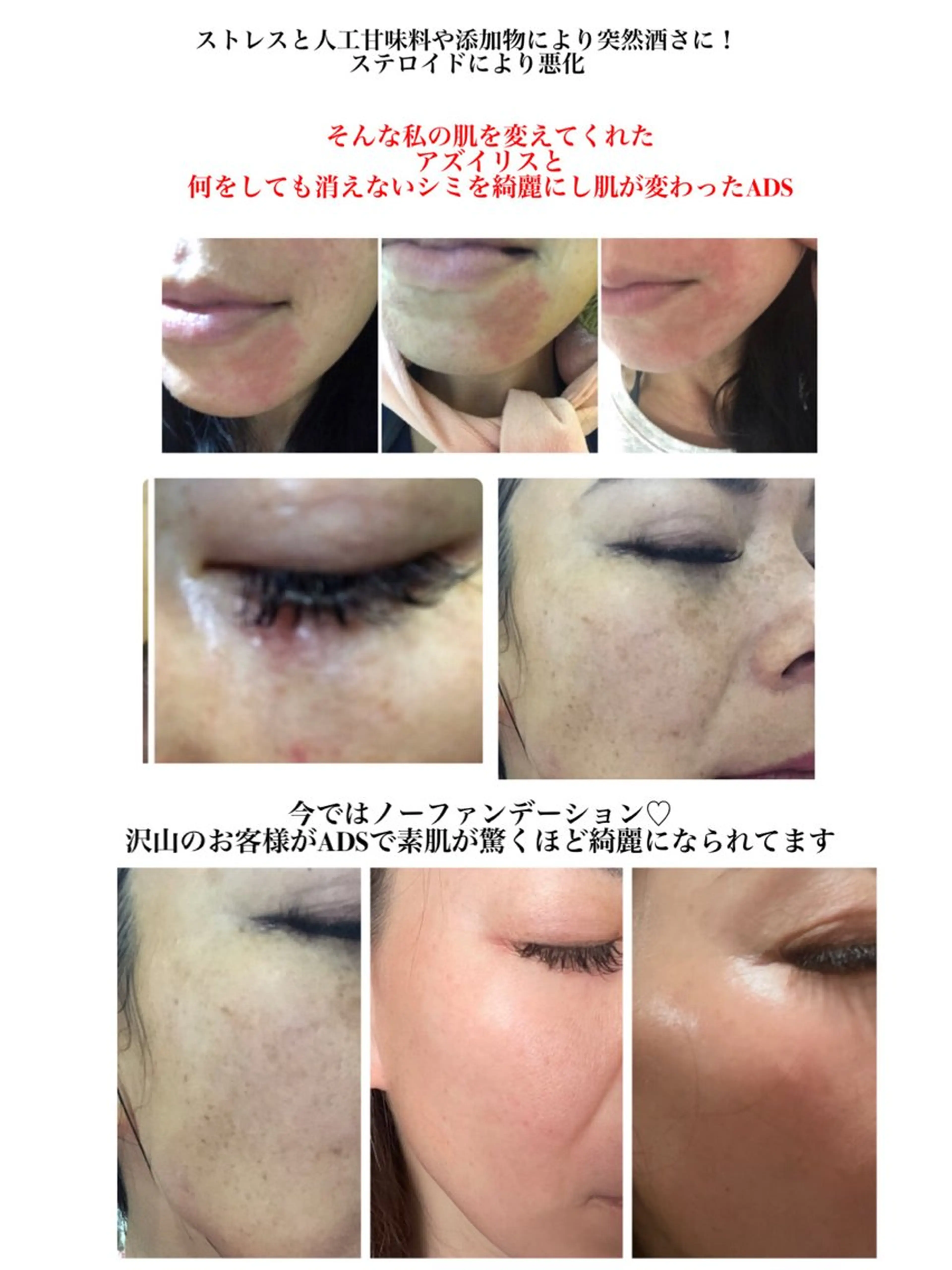 private salon Dea_maris シュガーリング&パーソナルボディケア所属・シミ改善・韓国肌管理 ボディメイク痩身のその他イメージ