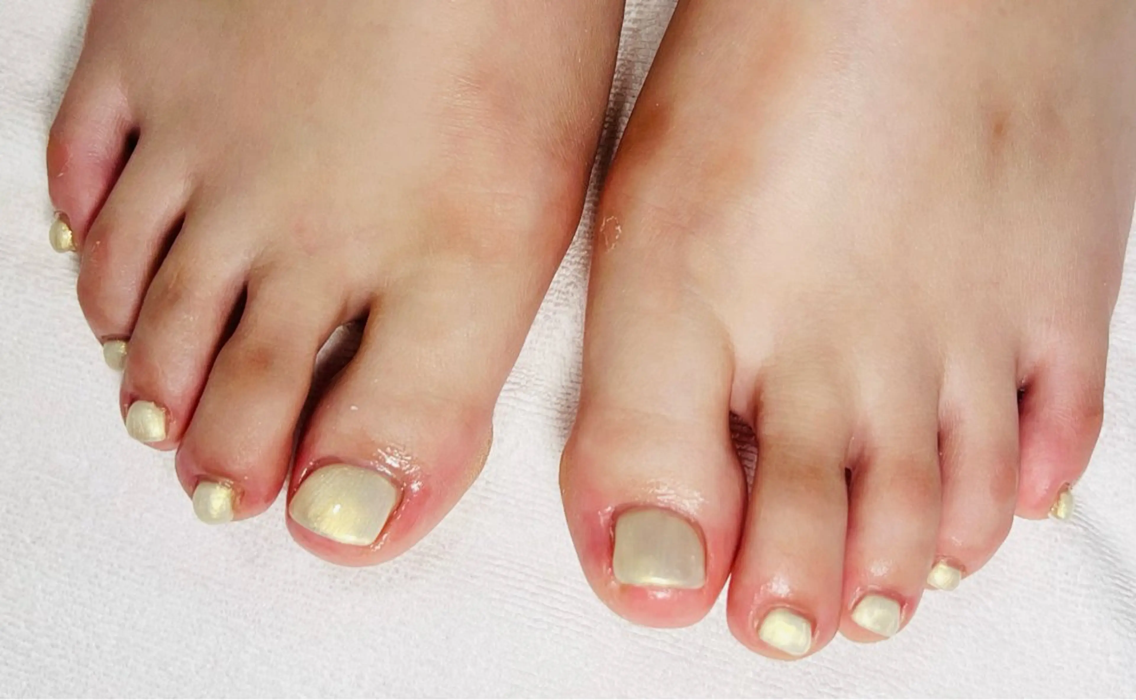 ネイル ネイルサロン ロア旧ジョリーのネイルデザイン