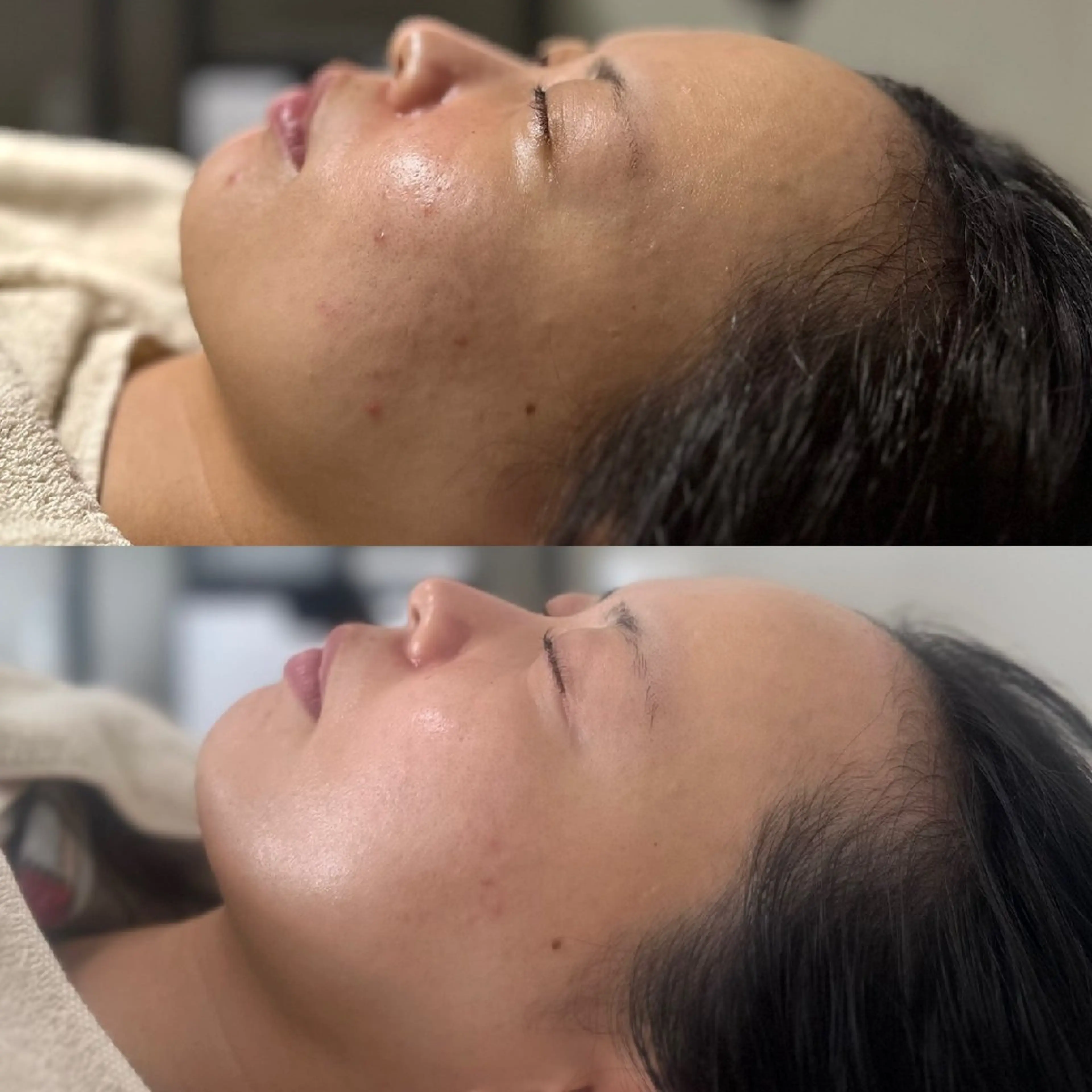 12月限定🎄ラミネーションピールモニター！《1回コース》の写真