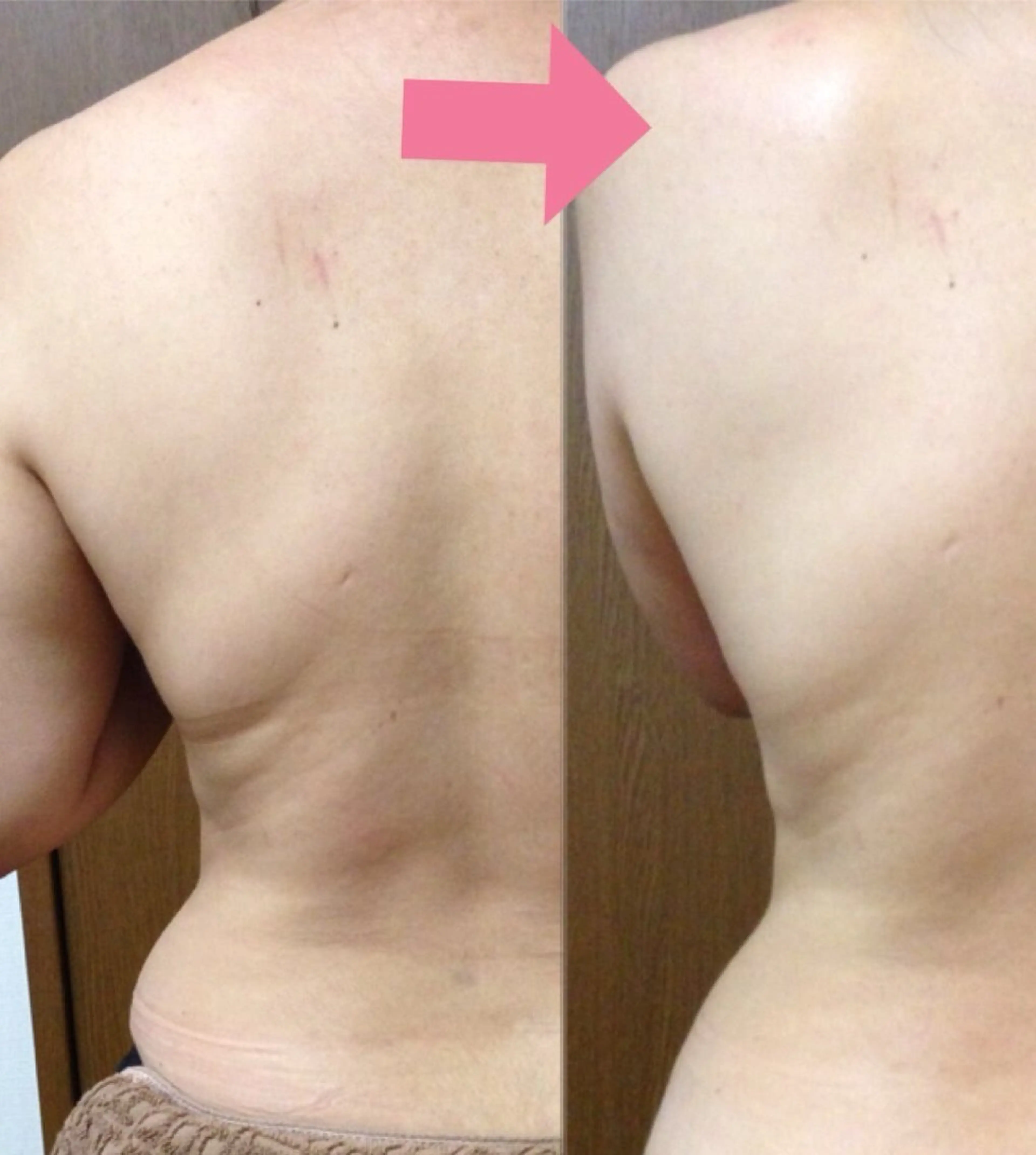 夏までに！ -5kgチャレンジのエステ・リラクイメージ