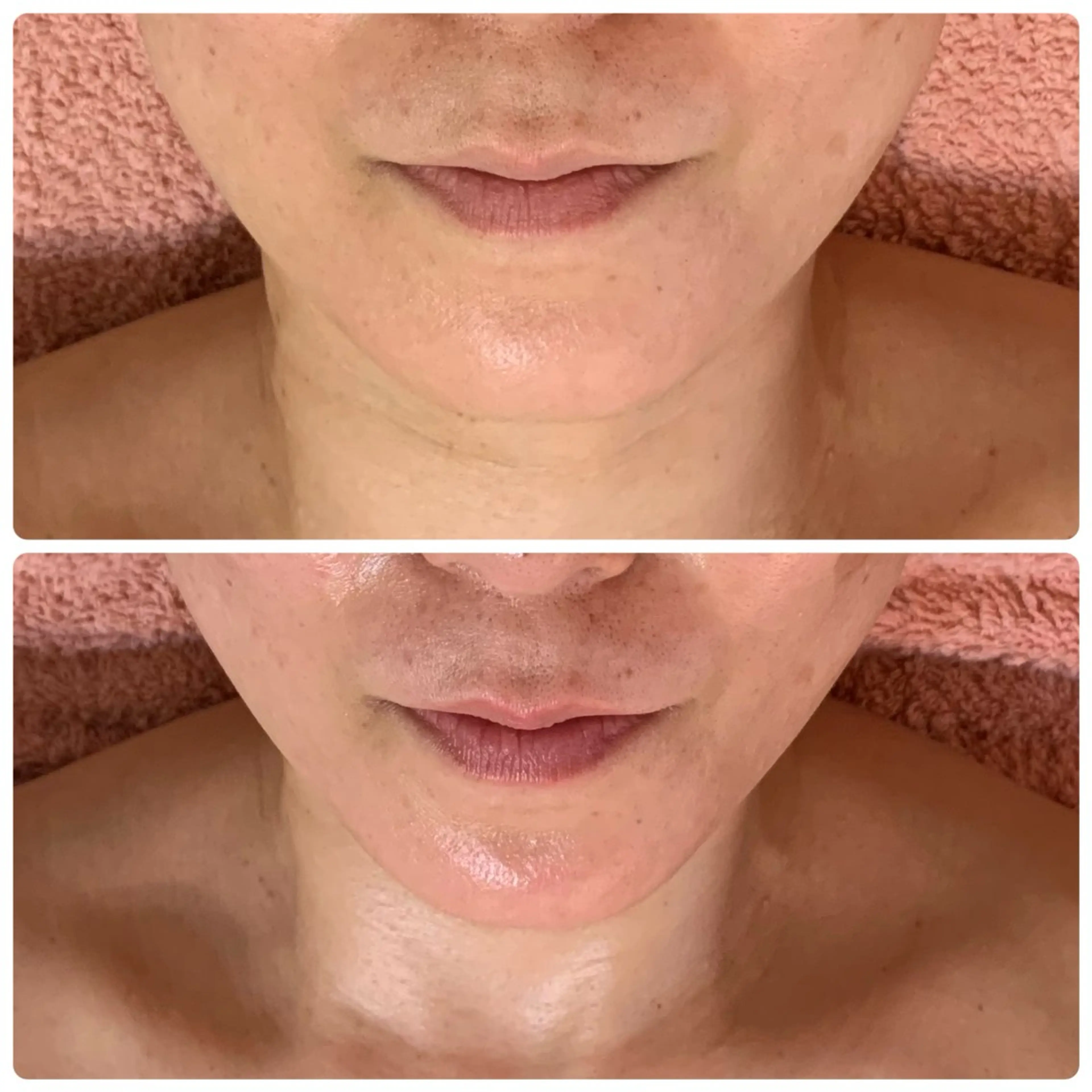 Suite Coutureのエステ・リラクイメージ