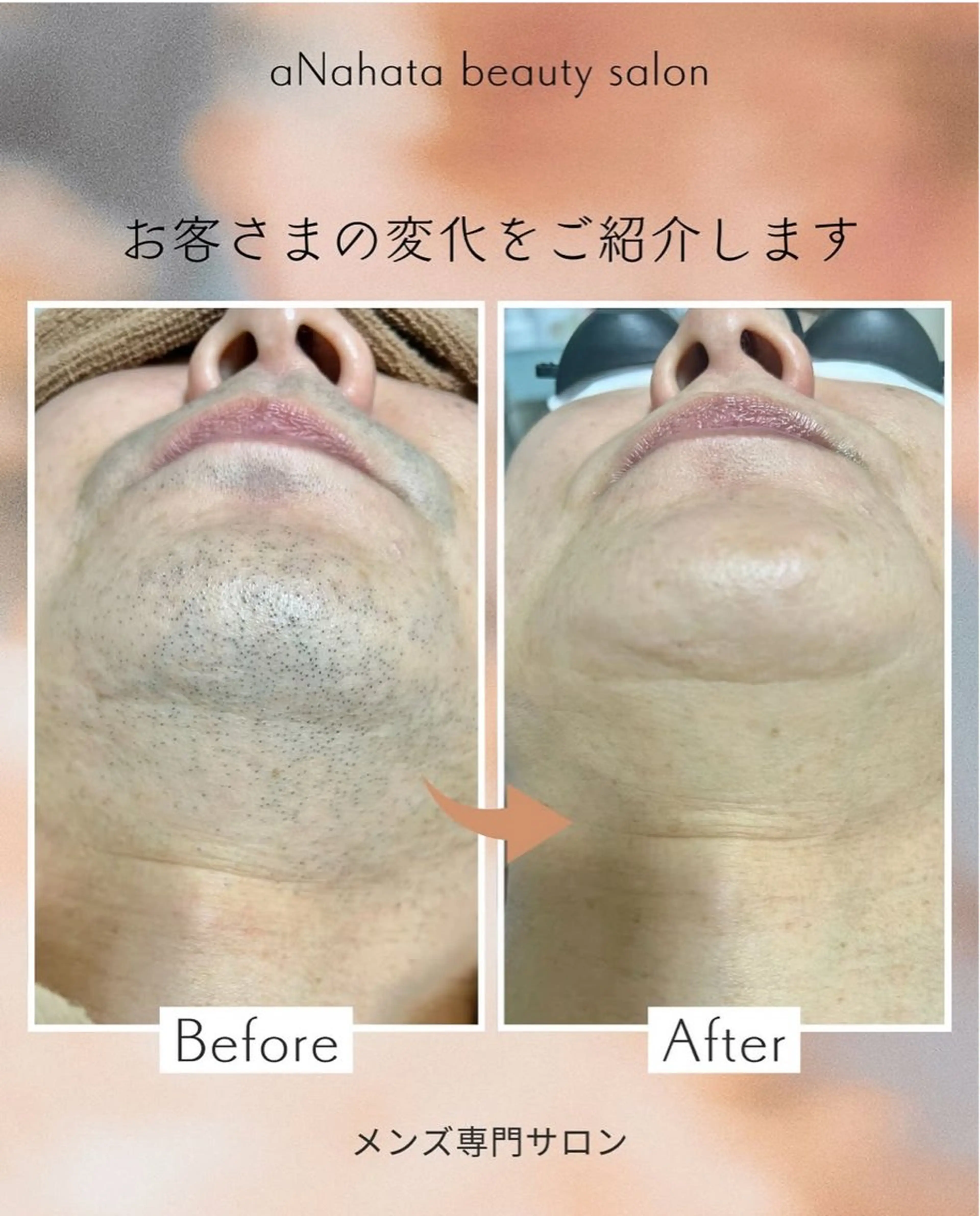 メンズ aNahata beauty salon所属・田中 菜月のエステ・リラクイメージ