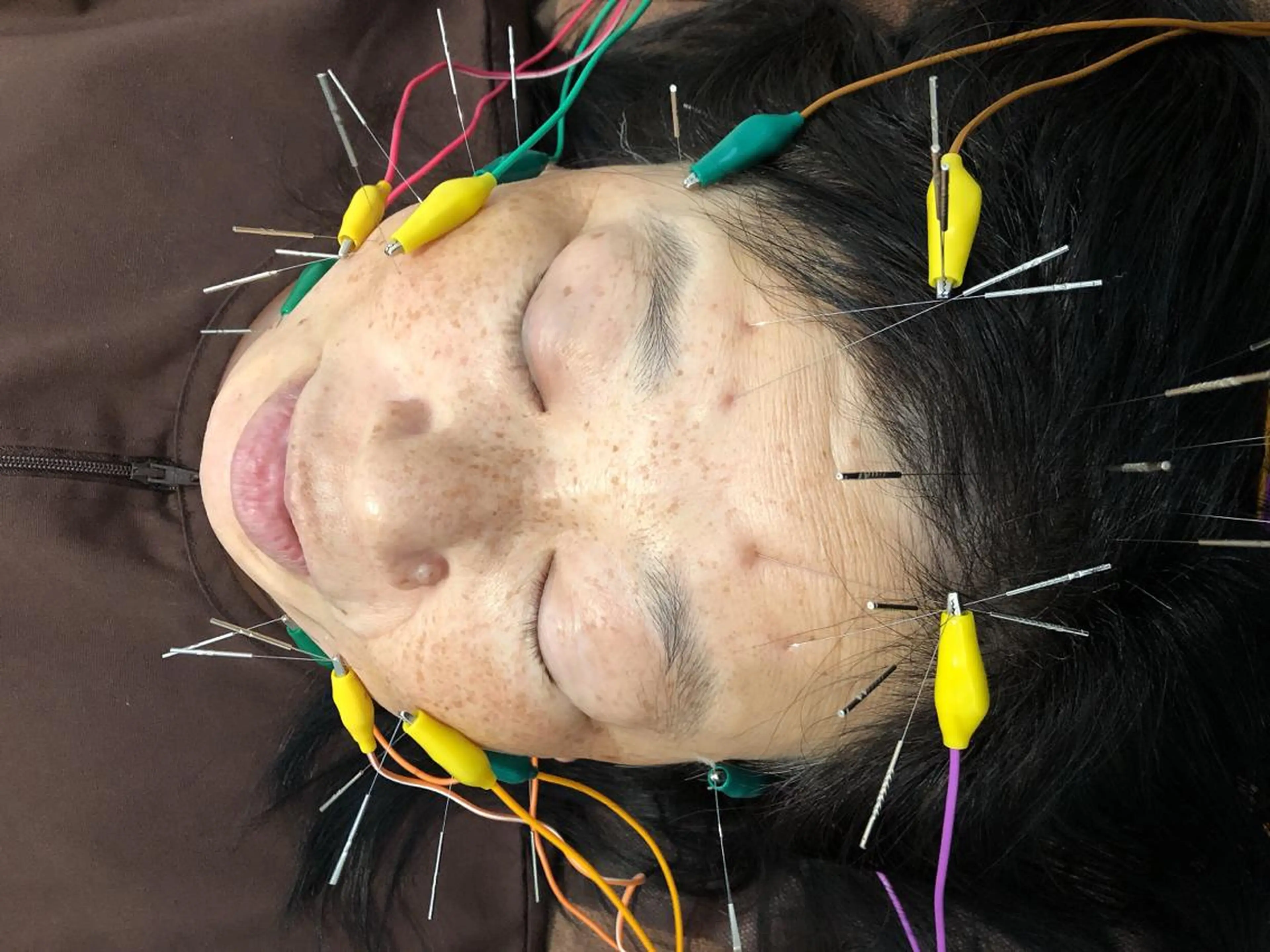 その他 美容鍼灸整体サロンBeauJu所属・小顔矯/美容鍼/鍼灸 BeauJuのその他イメージ