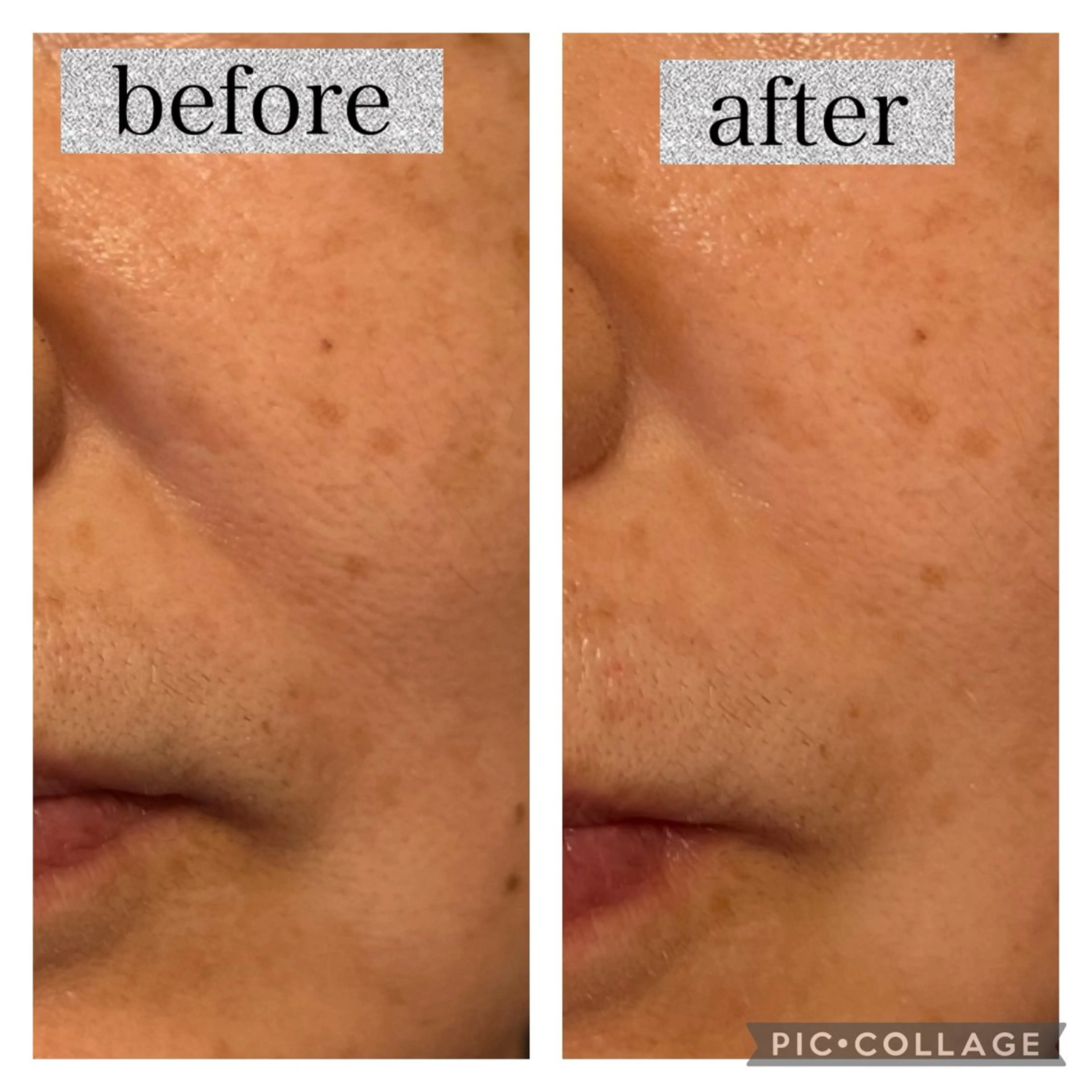 エステ Del’m白根所属・八木原公江 DeI'm白根のエステ・リラクイメージ