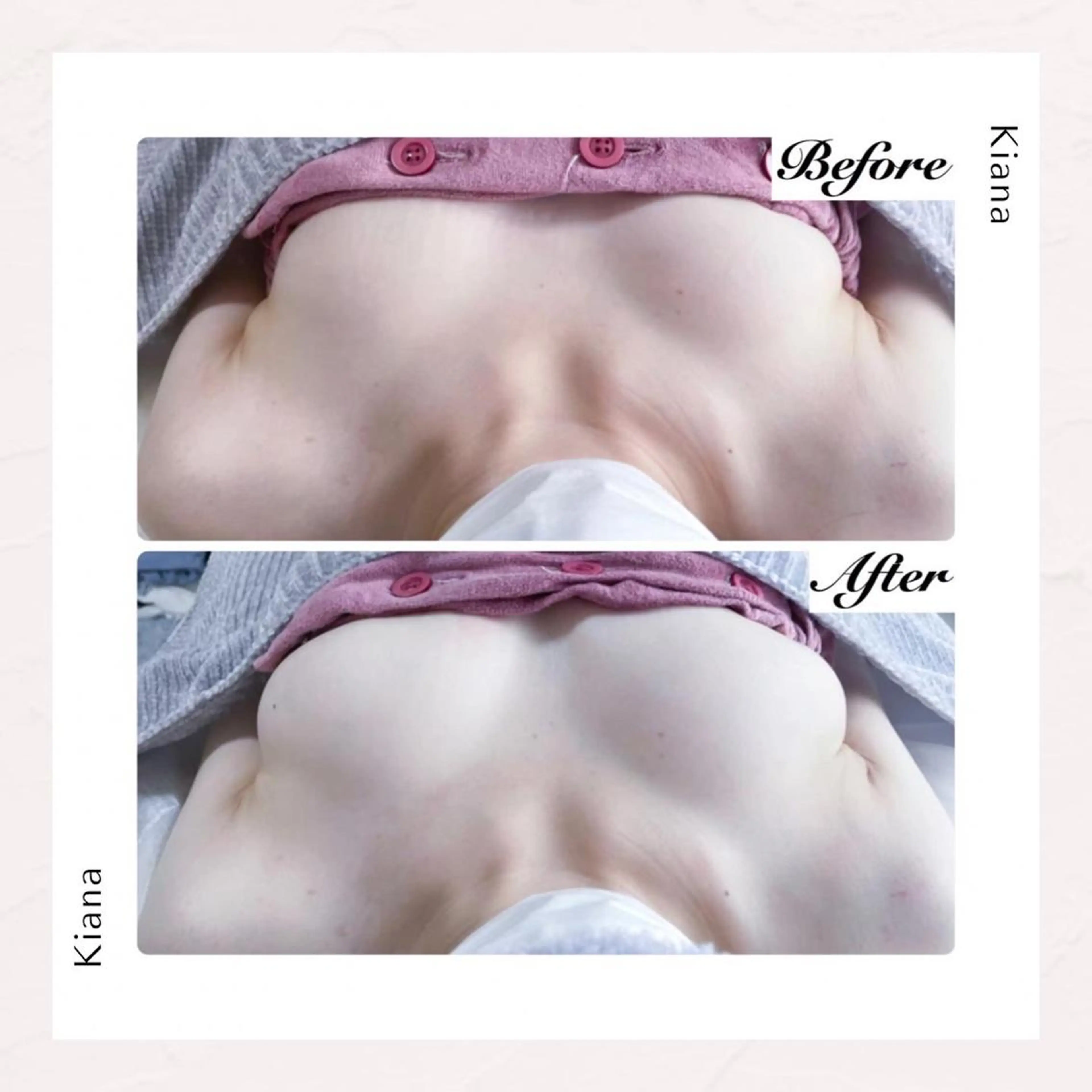 エステ リラク バスト専門Kiana 風のエステ・リラクイメージ