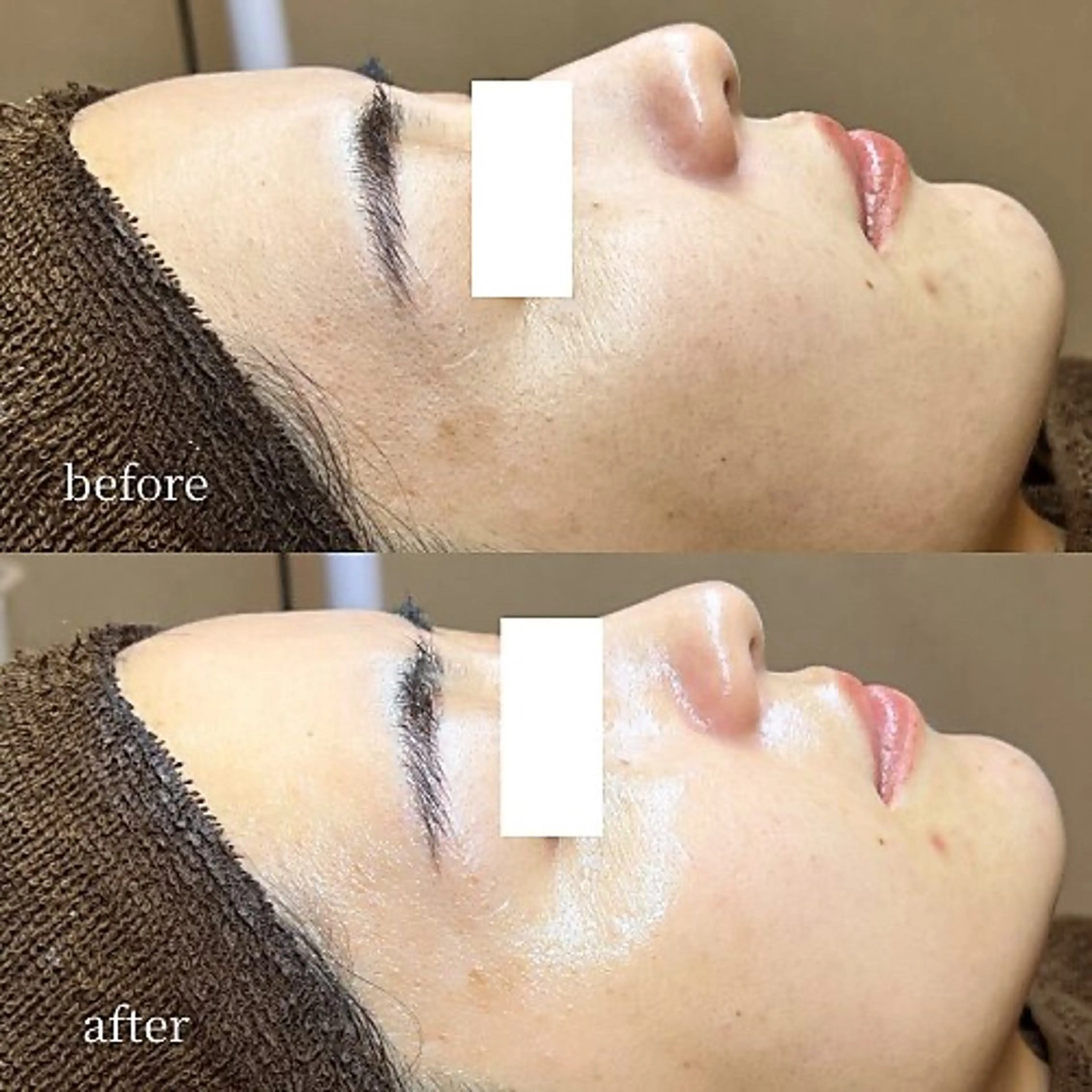 エステ 韓国肌管理・肌質改善 EARNEST心斎橋のエステ・リラクイメージ