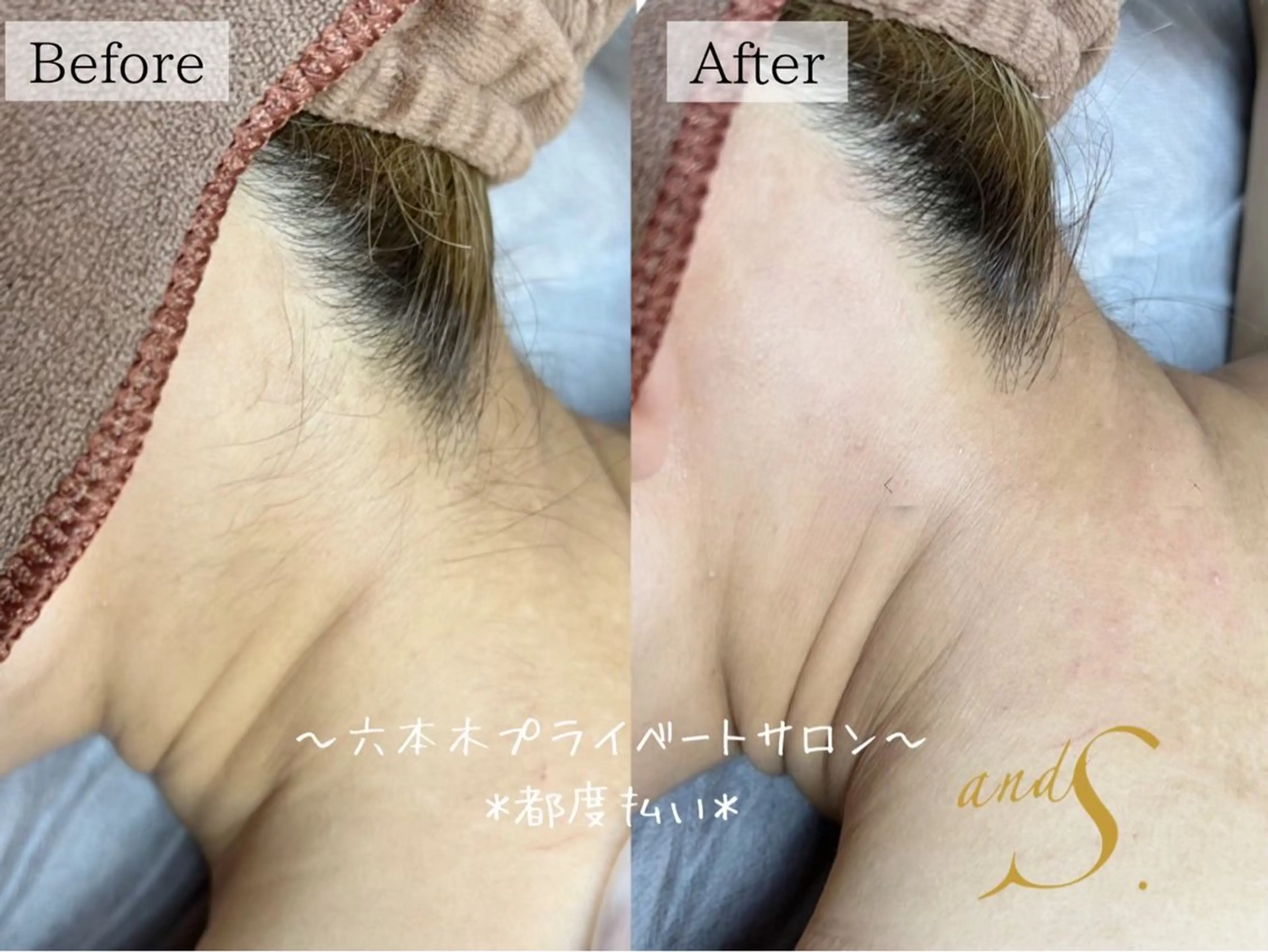 六本木脱毛andS 🍀yuriのエステ・リラクイメージ