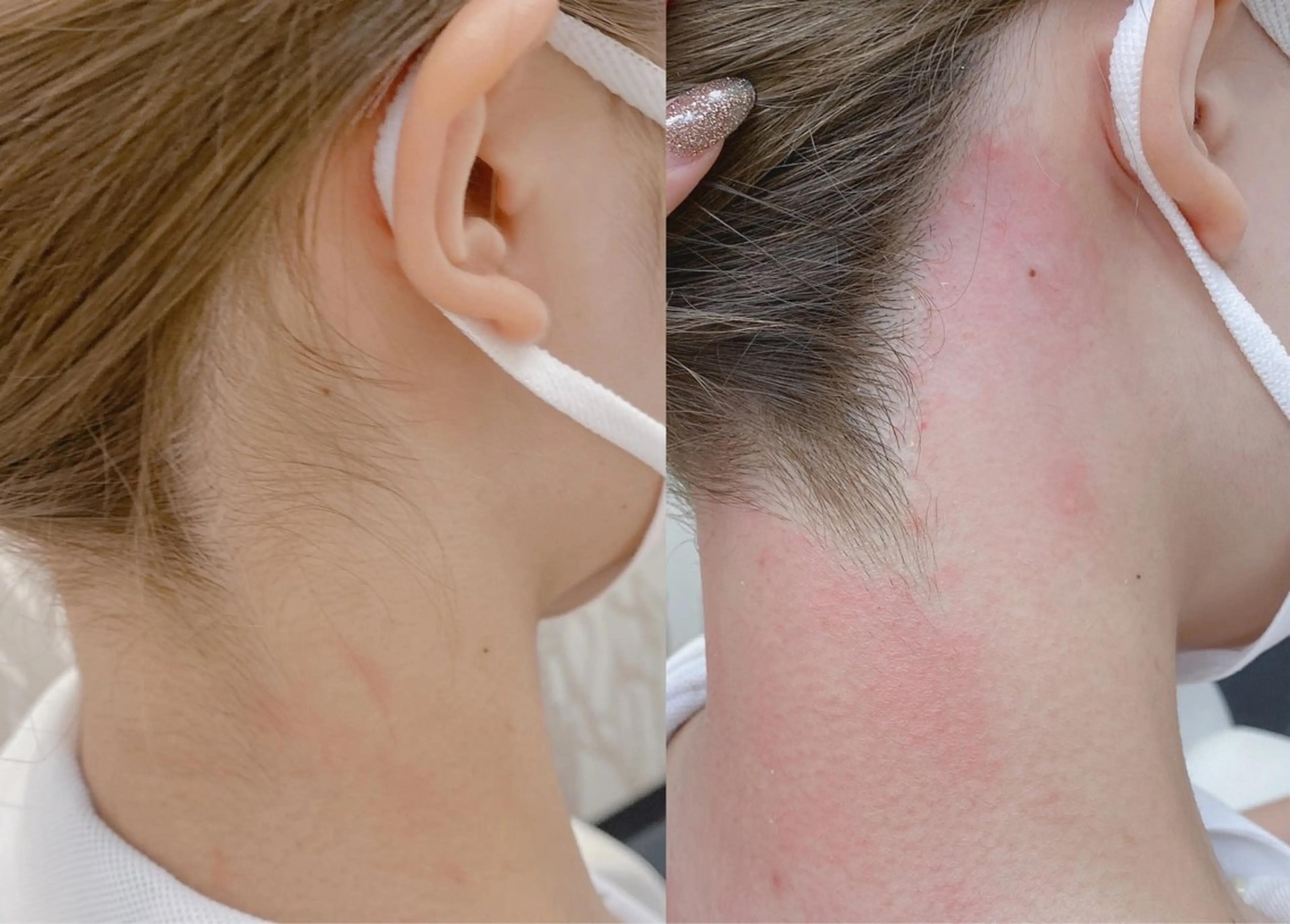 エステ Grace naoのマツエク・マツパデザイン