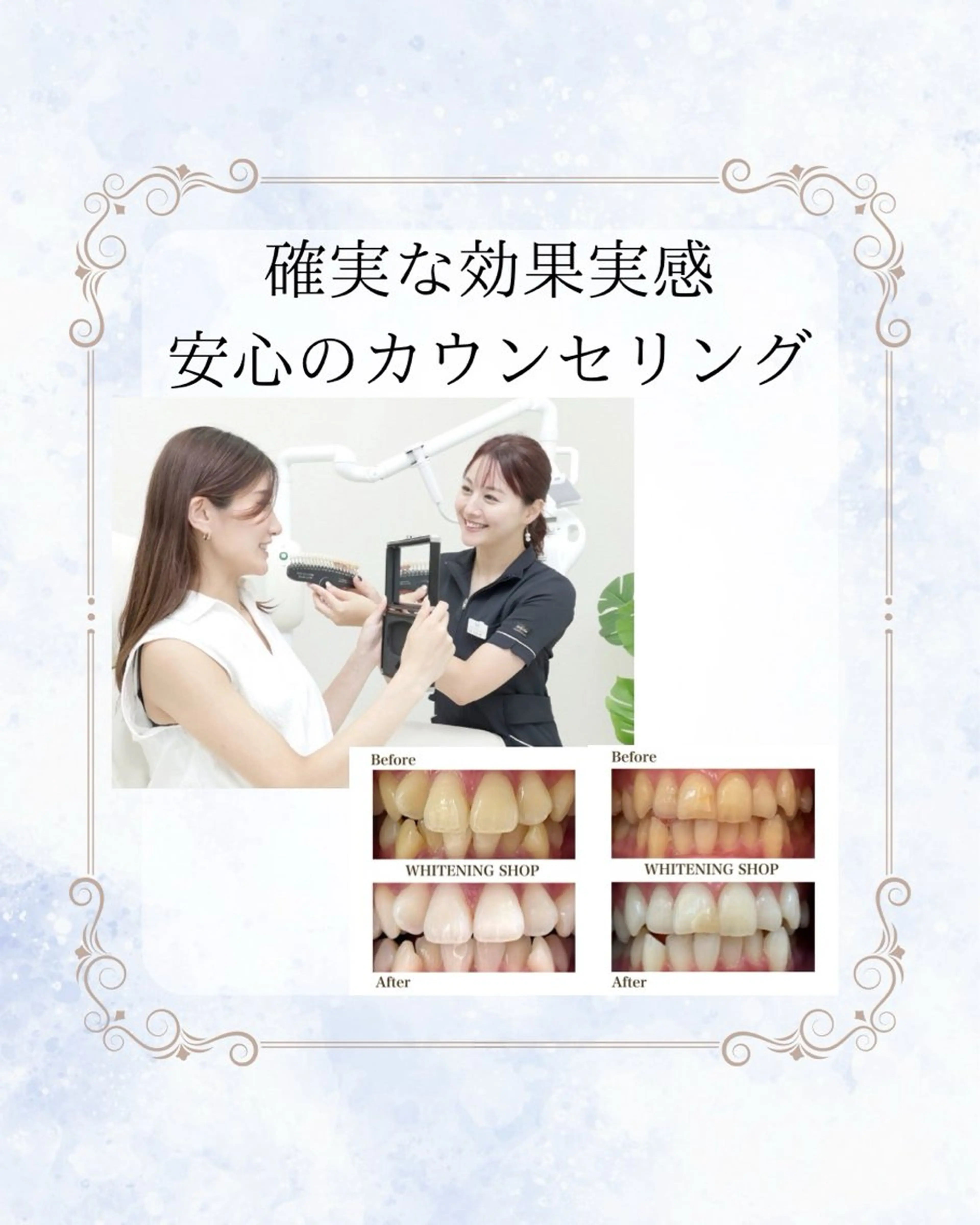 その他 ホワイトニングショップ静岡葵区店所属・ホワイトニング ショップ静岡葵区店のその他イメージ