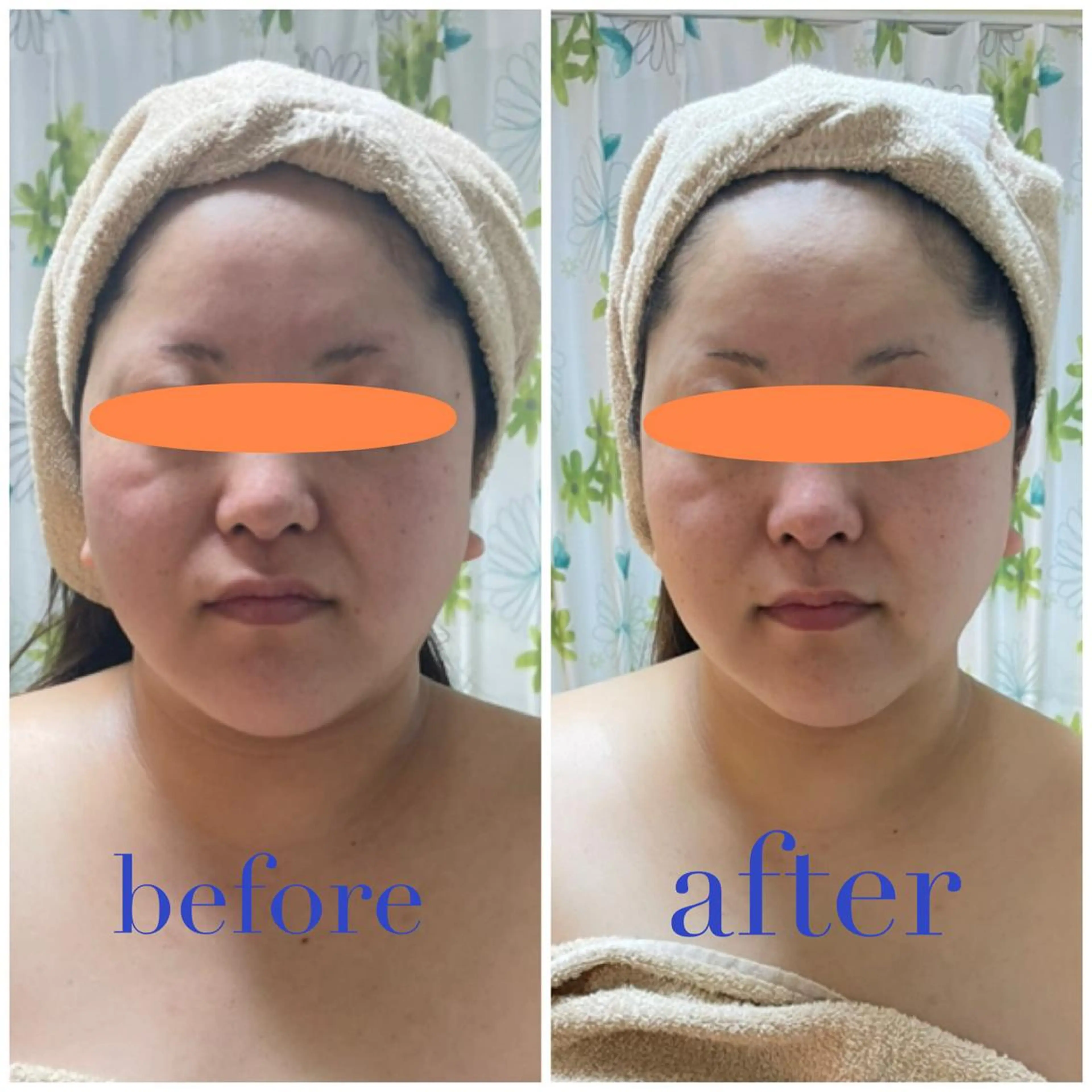 エステティック Nanagiのエステ・リラクイメージ