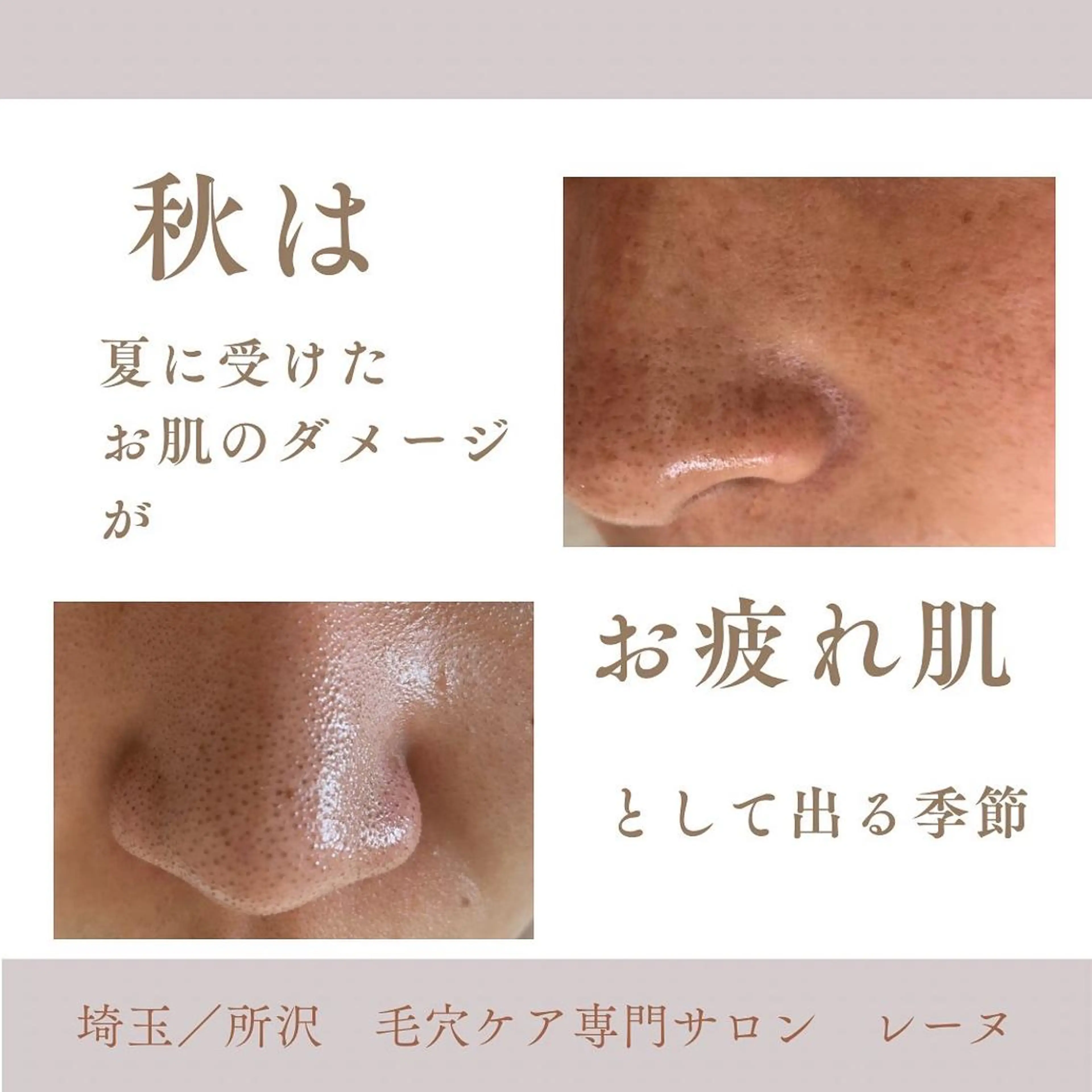 毛穴ケア専門サロン レーヌのエステ・リラクイメージ