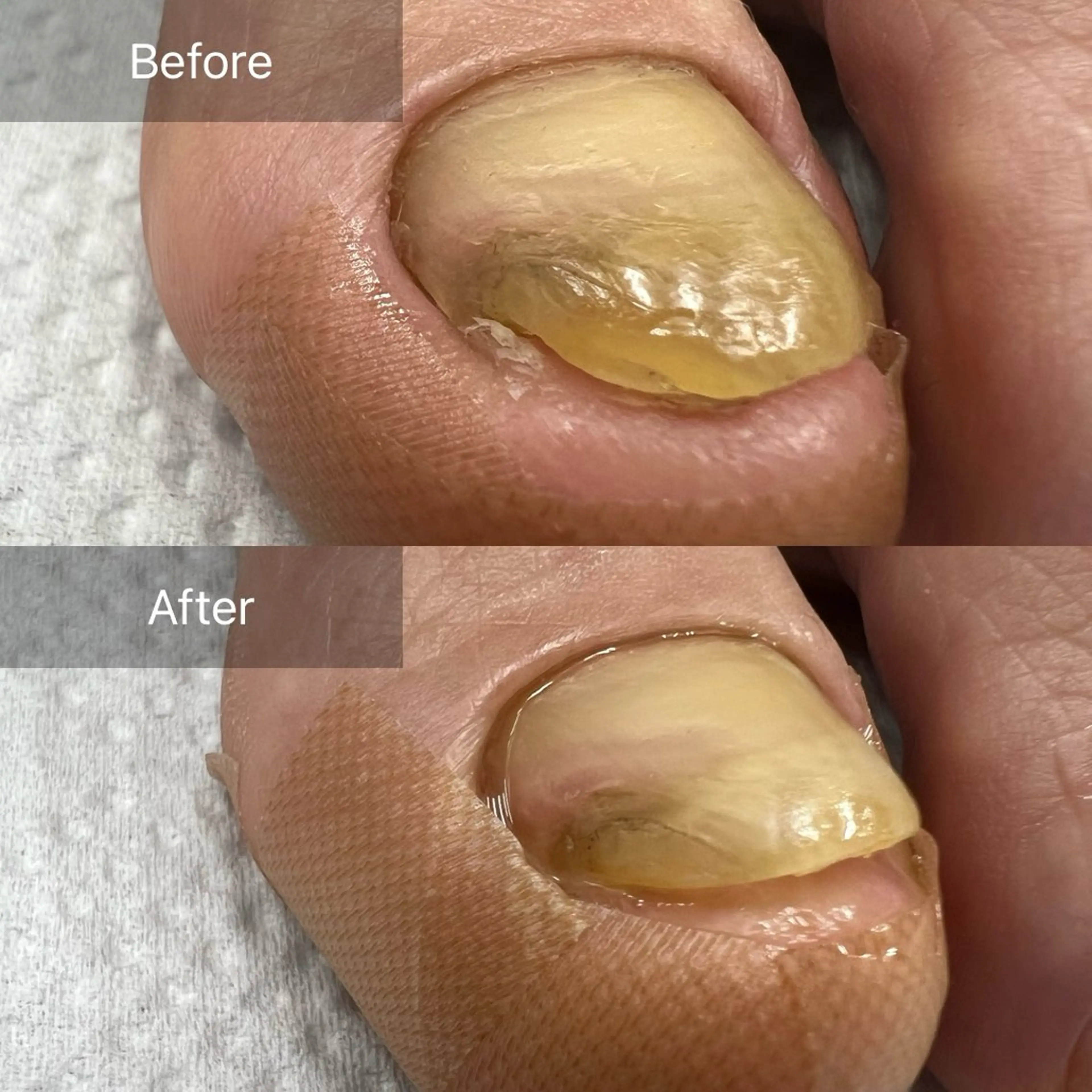 ネイル Belulu所属・Belulu ベルルのネイルデザイン