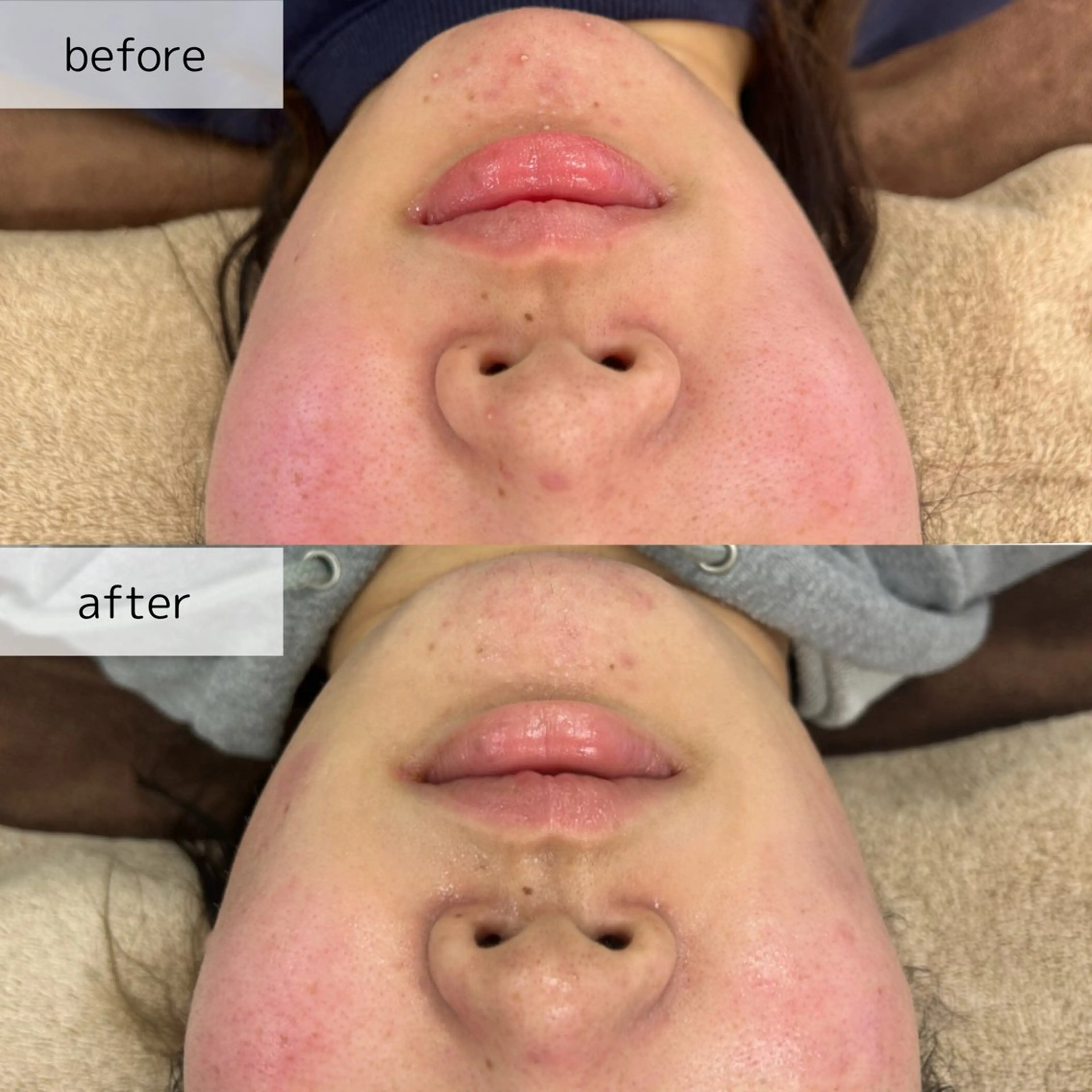 エステ Venus所属・エステサロン Venusのその他イメージ