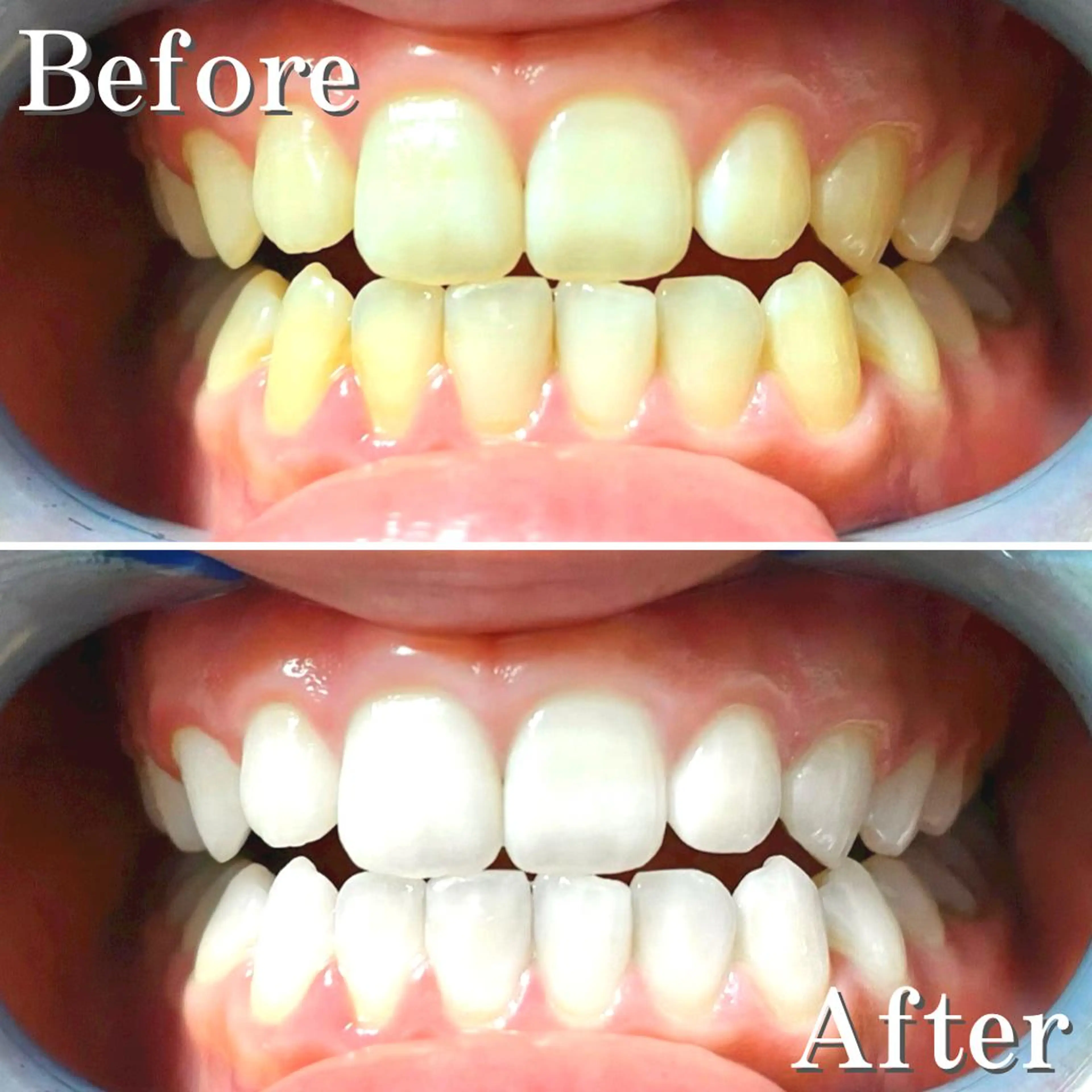 カラー パーマ アイブロウ ネイル マツエク・マツパ メンズ ヘアアレンジ 結婚式・ブライダル メンズアイブロウ 結婚式・ブライダル メンズネイル ブライダルネイル その他 LBSホワイトニング 銀座店💎公式のその他イメージ