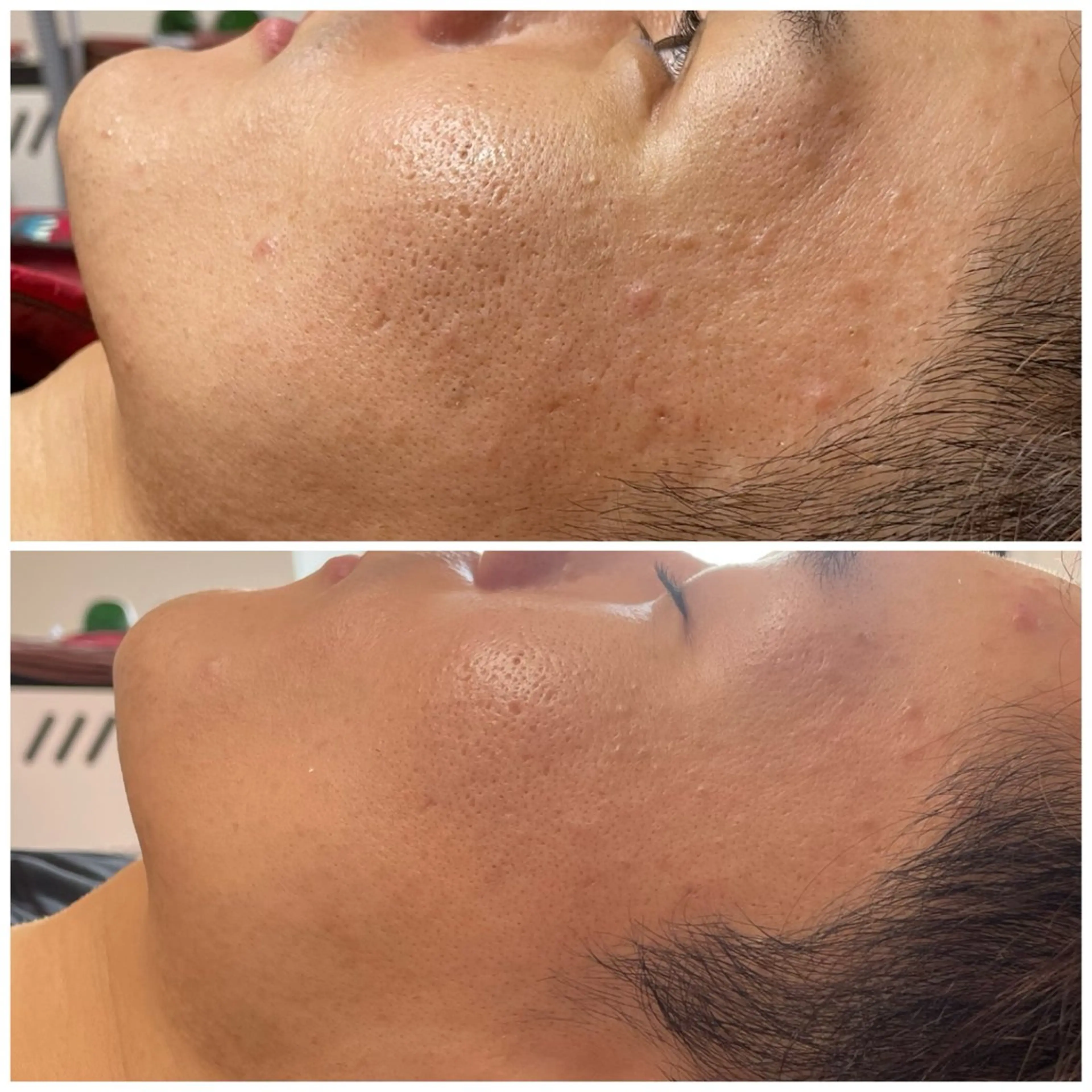 毛穴レス ハーブ＆ ワックス脱毛×光脱毛のエステ・リラクイメージ