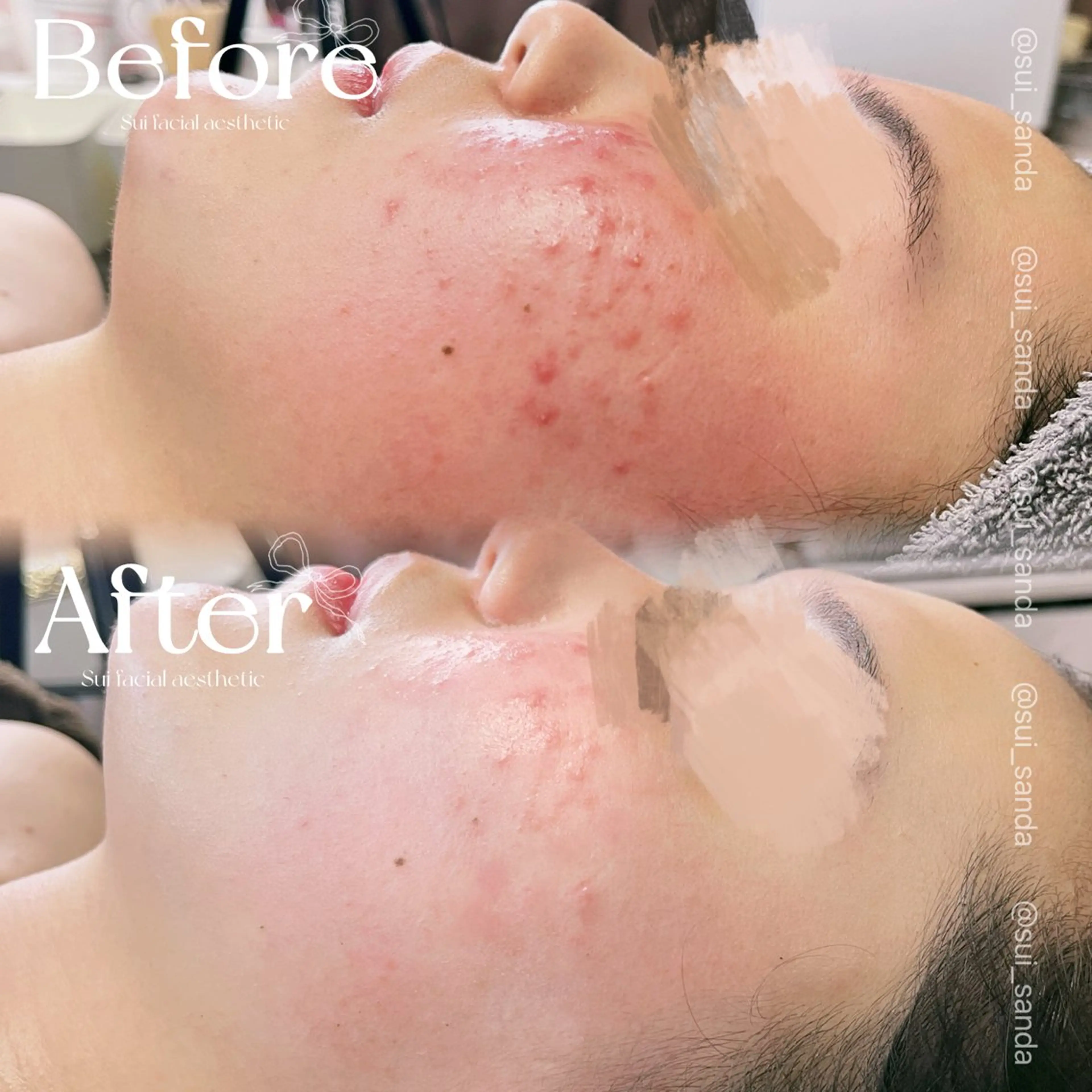 エステ Sui所属・Sui Eye & Beautyのマツエク・マツパデザイン